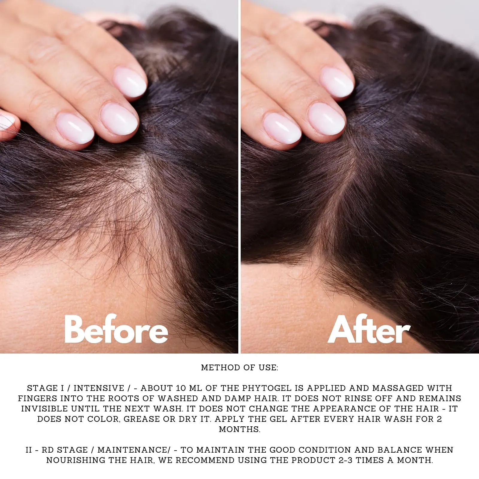 Гель ALZEDA проти випадіння волосся, сприяє росту для сильного волосся, фото №3