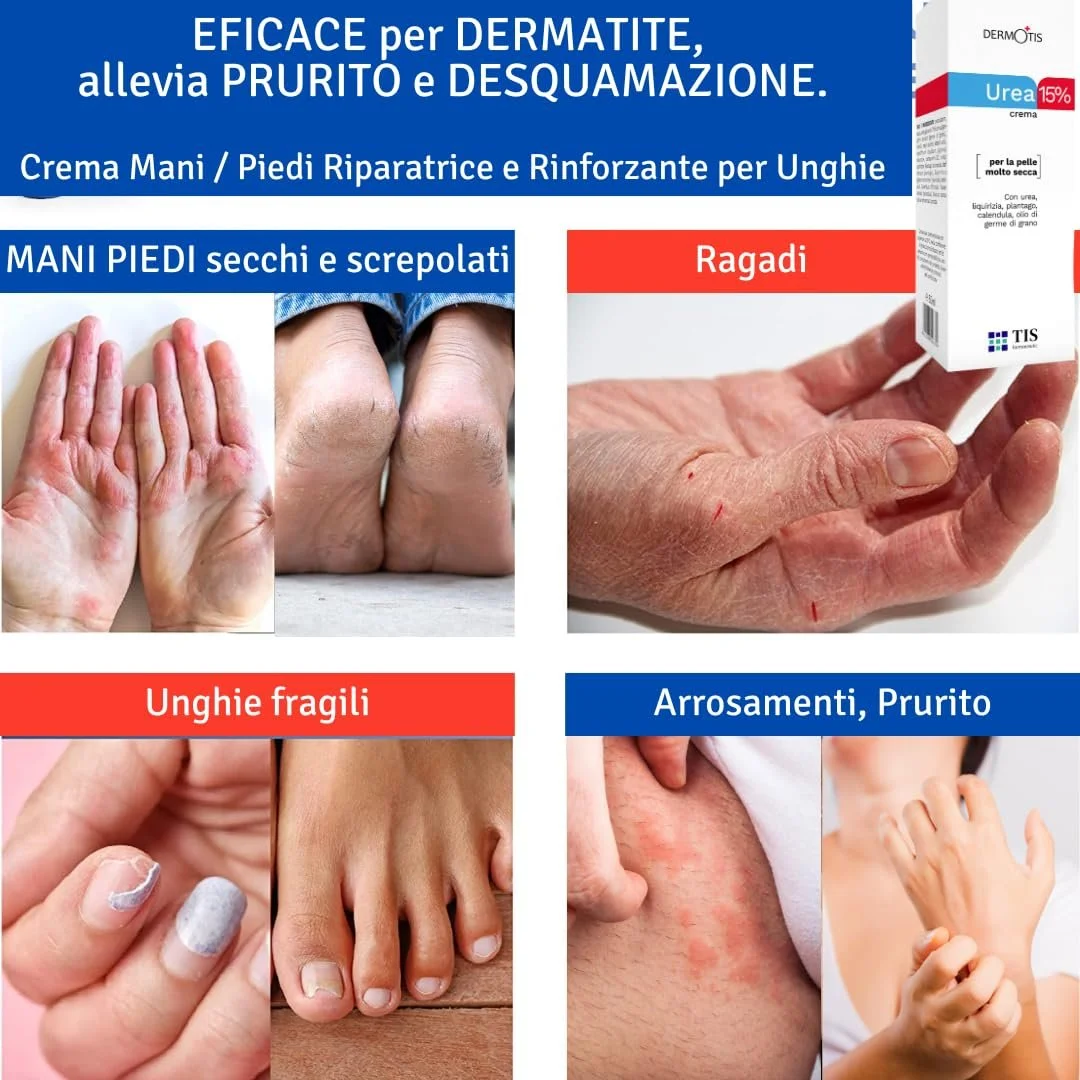 Крем для ног TIS Urea 15% с молочной кислотой AHA и зародышами пшеницы, фото №4