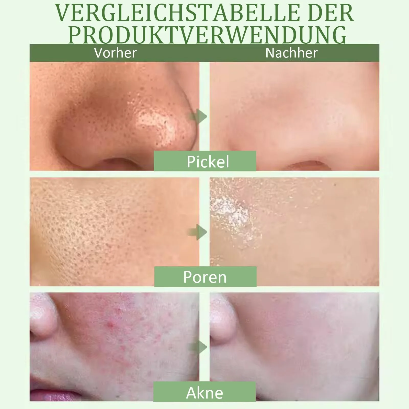 Маска-стік Зелений чай для глибокого очищення, звуження пор і балансу вологи, видаляє чорні цятки Упаковка з 2 масок, фото №6