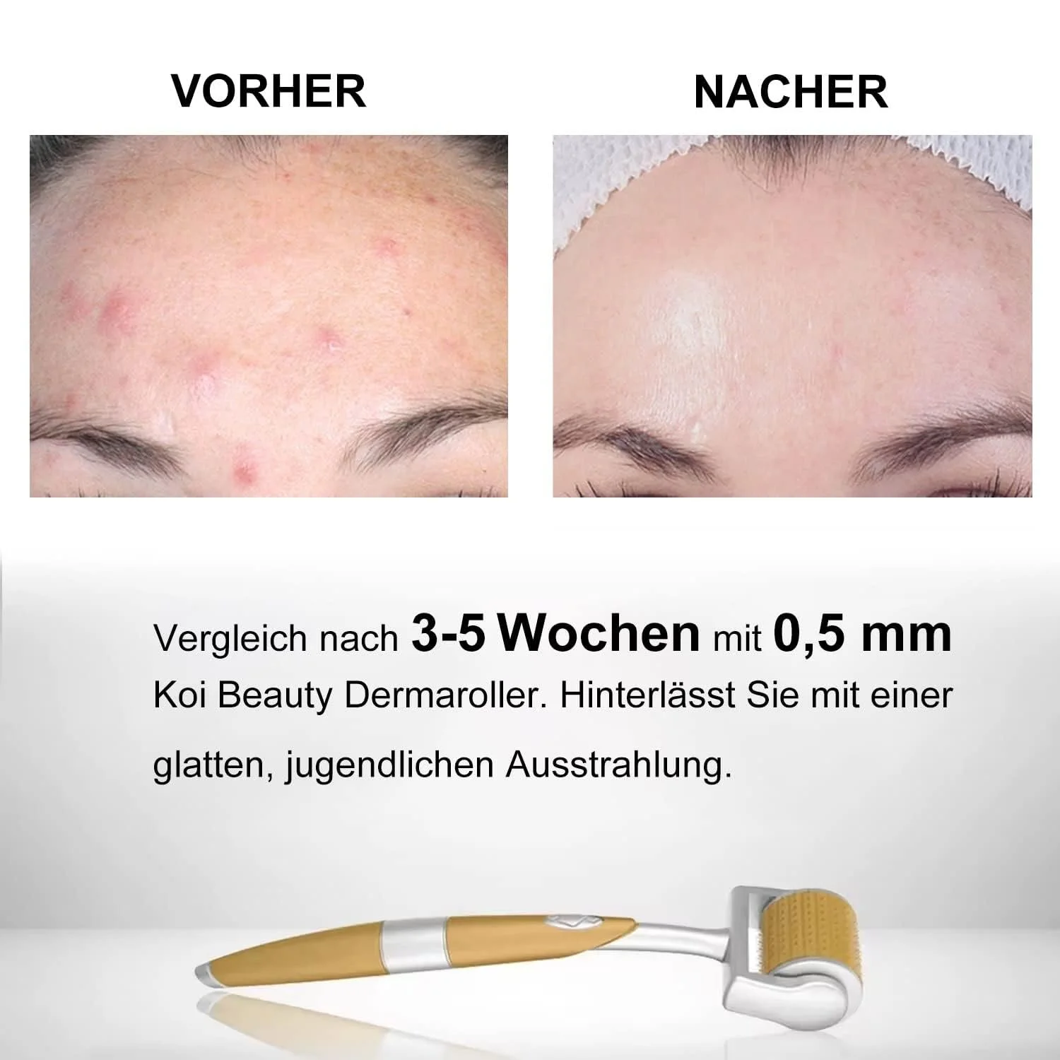 Дермаролер Koi Beauty 0,5 мм, 192 голки, фото №4