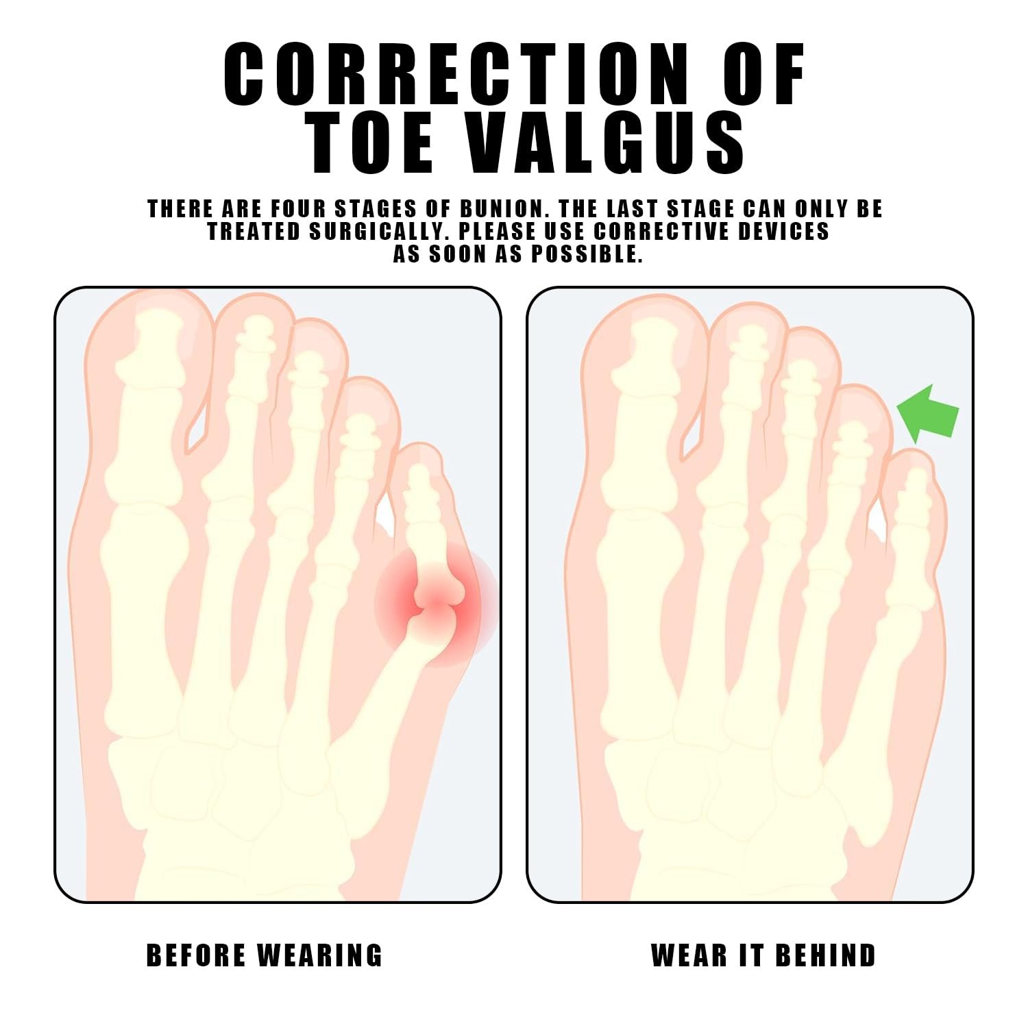 Роздільники для пальців ніг, фото №6