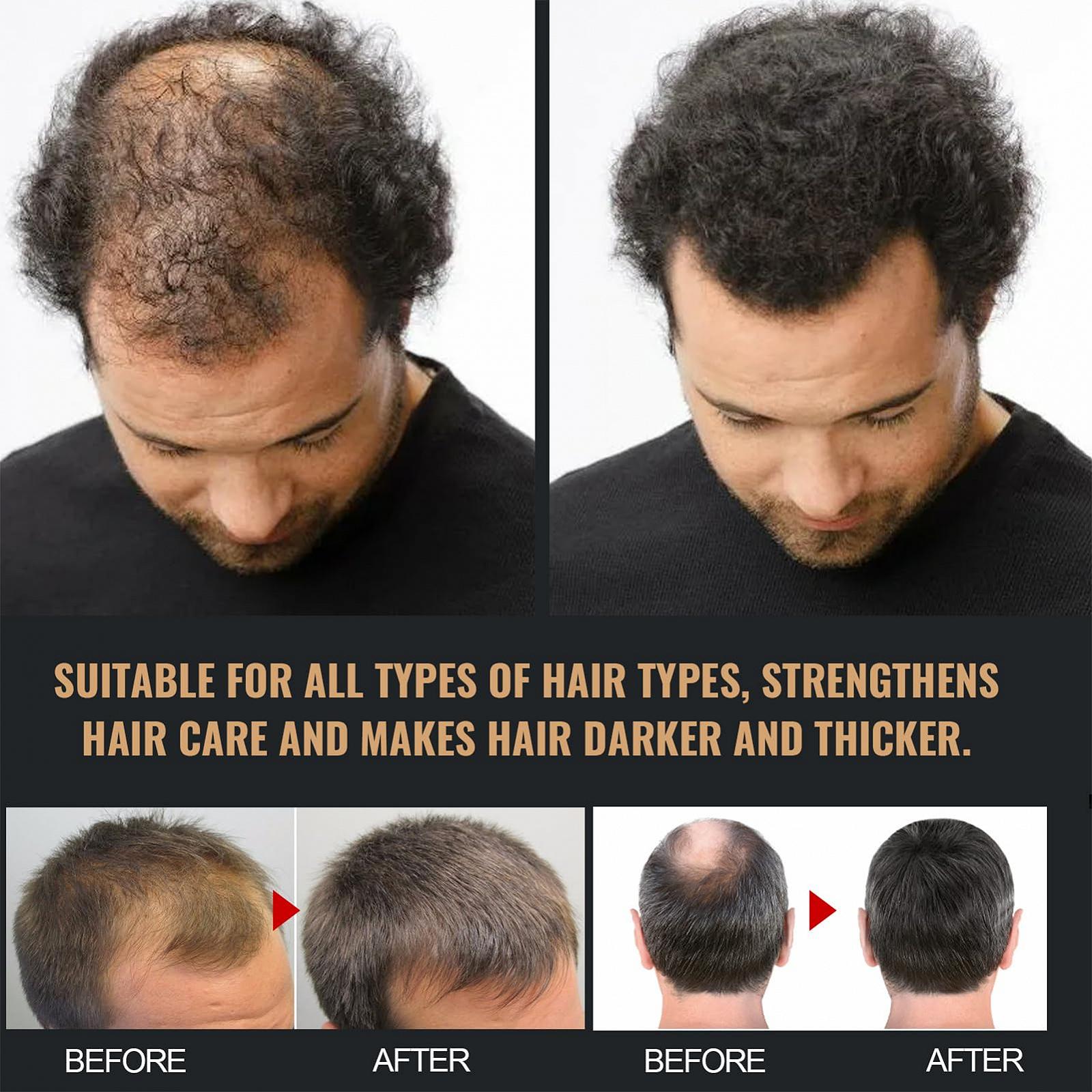 Шампунь Fashion Base Spartan Root Activator Удаляет токсины и питает кожу головы и волосы, фото №4 Шампунь Fashion Base Spartan Root Activator Удаляет токсины и питает кожу головы и волосы, фото №4