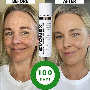 Тональний крем Evonex Age Defying Серум для обличчя Тонований Сонцезахисний Крем Універсальний Тон 3 штуки synthetic.ua - Фото 1