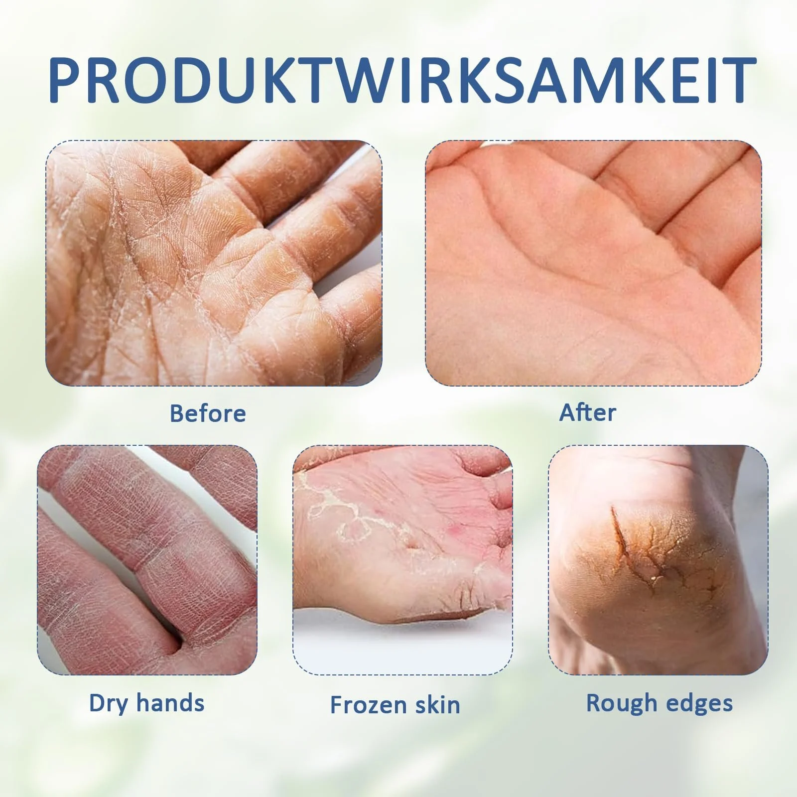 Крем с мочевиной Urea Cream 40% Urea для рук и ног, увлажняющий, отшелушивающий, набор из 2 шт., фото №6