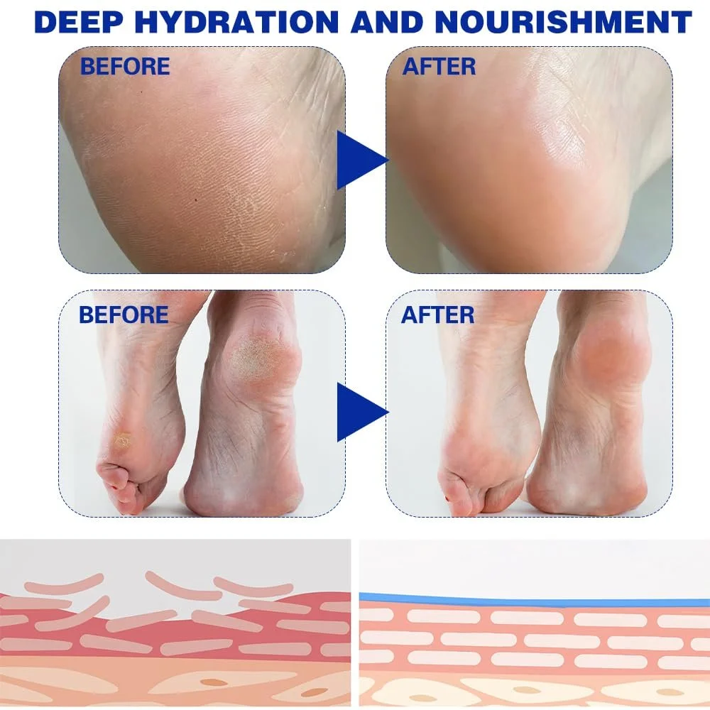 Крем-стик для ног Fengyang Urea для локтей, коленей, стоп и рук, фото №2