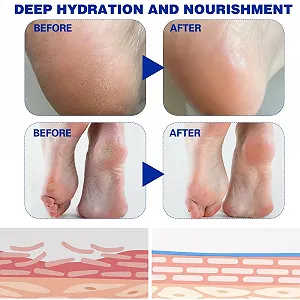 Крем-стик для ног Fengyang Urea для локтей, коленей, стоп и рук synthetic.ua - Фото 1