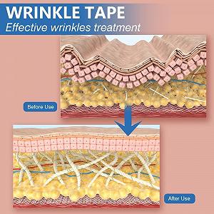 Тейп для обличчя Sfuchin 2 рулони 2,5 см x 5 м synthetic.ua - Фото 1