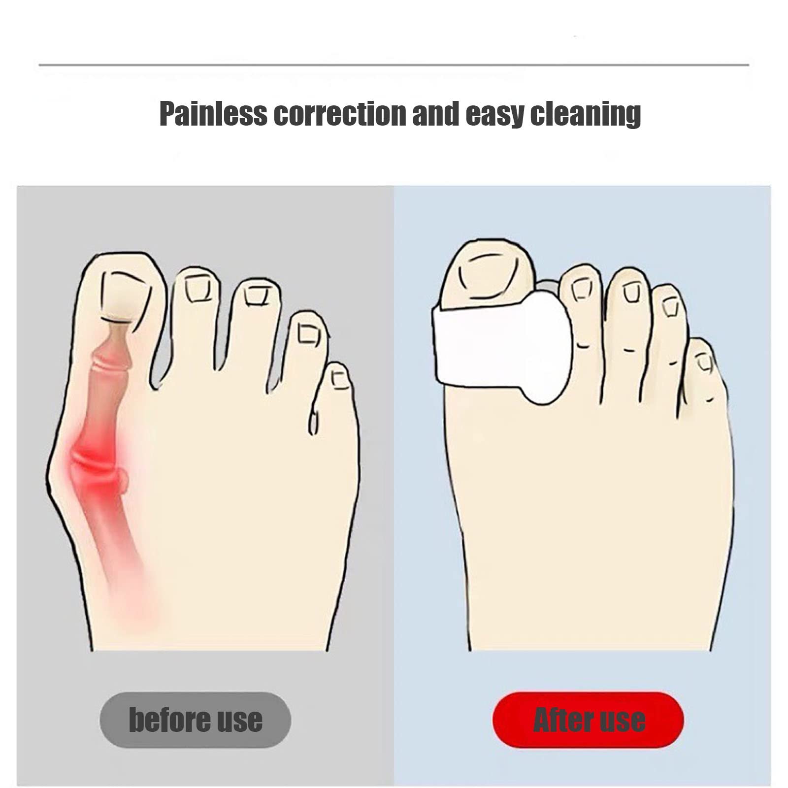 Коректор для большого пальца стопы для женщин и мужчин Ultra Thin Bunion Socks Ортопедический, фото №4 Коректор для большого пальца стопы для женщин и мужчин Ultra Thin Bunion Socks Ортопедический, фото №4