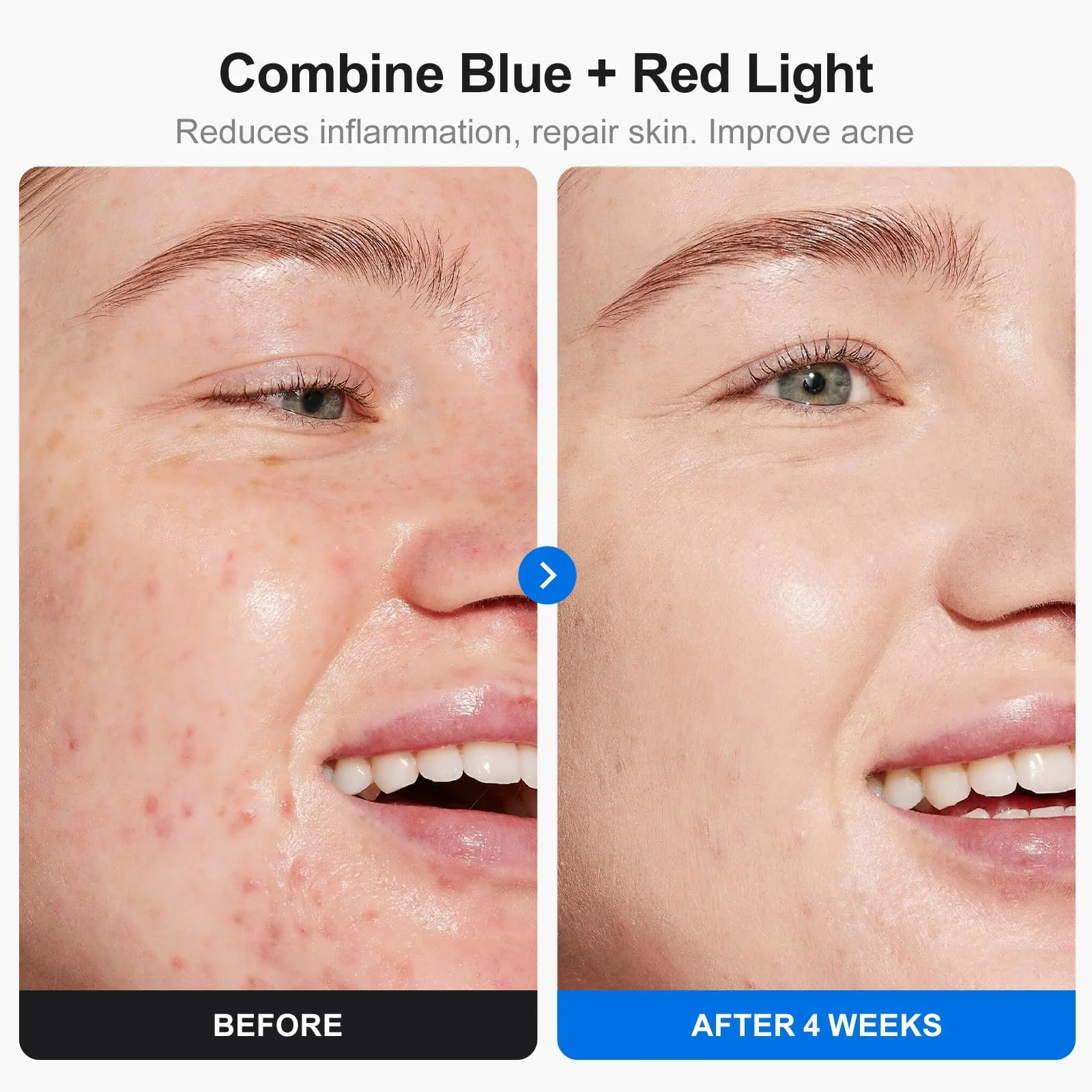 LED Маска для лица Profey 7 цветов, Маска с красным светом, для омоложения кожи и против морщин, фото №3 LED Маска для лица Profey 7 цветов, Маска с красным светом, для омоложения кожи и против морщин, фото №3