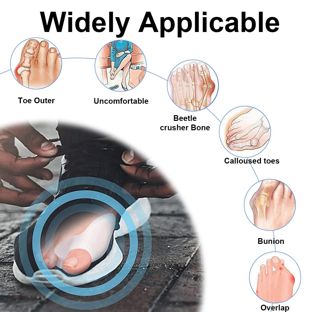 Роздільники для пальців ніг для корекції Hallux Valgus, фото №6 Роздільники для пальців ніг для корекції Hallux Valgus, фото №6