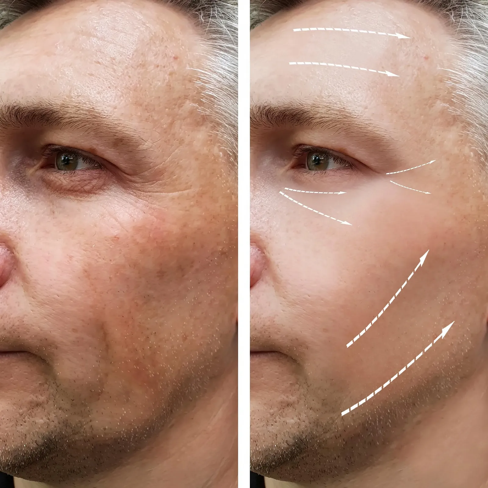 Денний крем MAN42 Anti-Age 3.1 3-в-1 для чоловіків, 100 мл, фото №6 Денний крем MAN42 Anti-Age 3.1 3-в-1 для чоловіків, 100 мл, фото №6