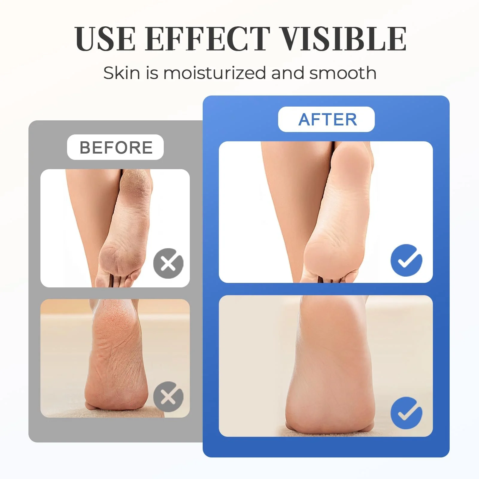 Крем для ног увлажняющий против трещин с 60% Urea 40 г, фото №4 Крем для ног увлажняющий против трещин с 60% Urea 40 г, фото №4