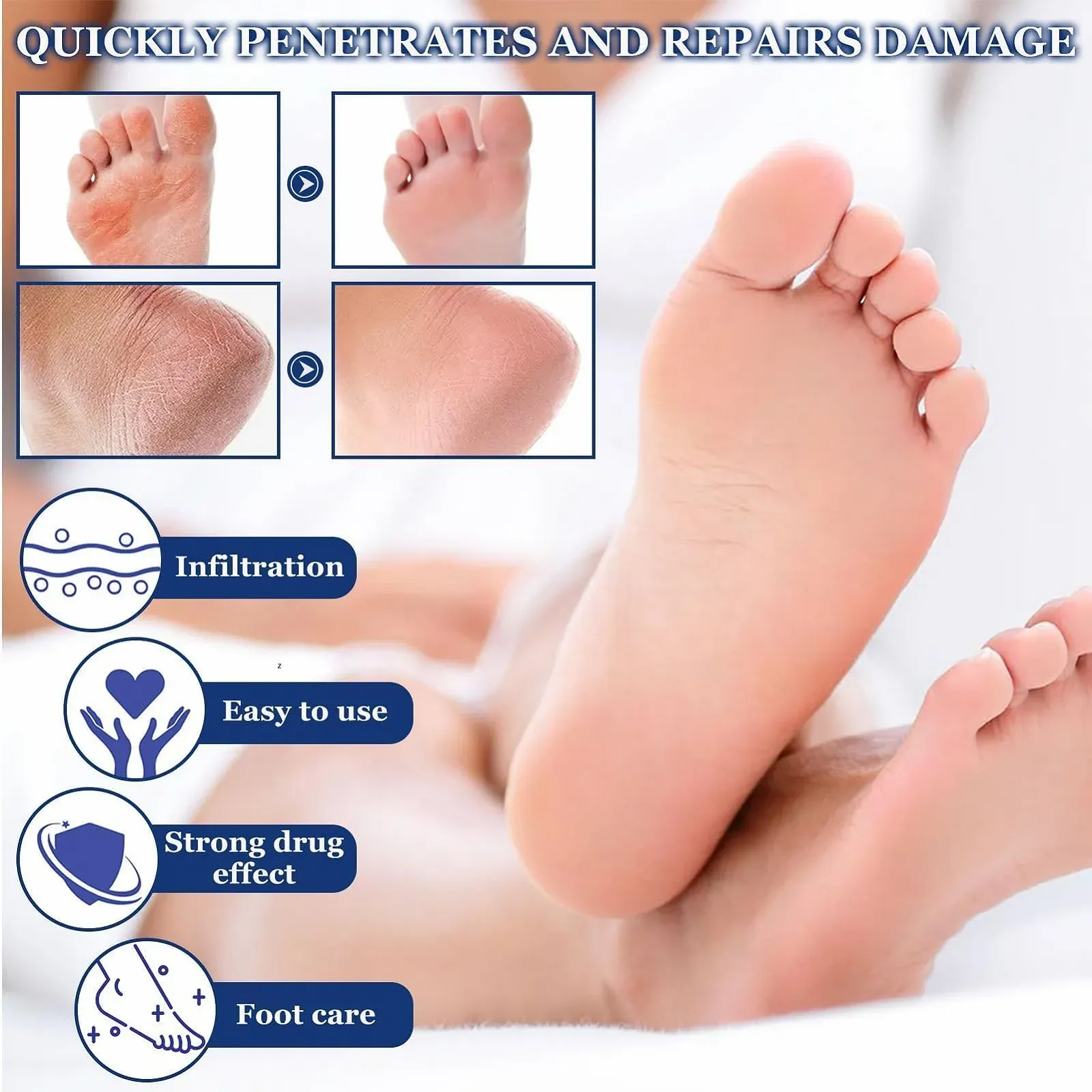 Крем для ног с мочевиной 60% и салициловой кислотой для сухой и потрескавшейся кожи 100 г, фото №3