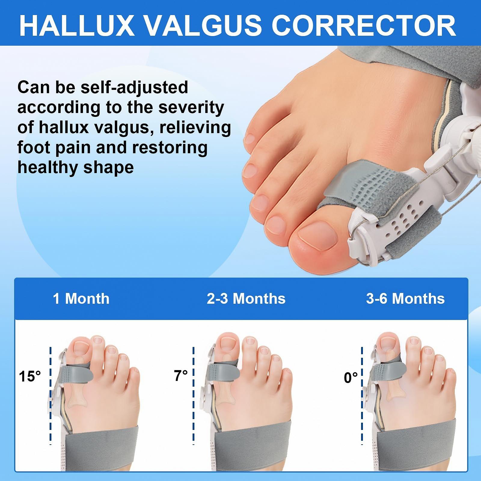 Шина для коррекции Hallux Valgus Регулируемая, 1 шт + Носки для Hallux Valgus, 2 шт, фото №3