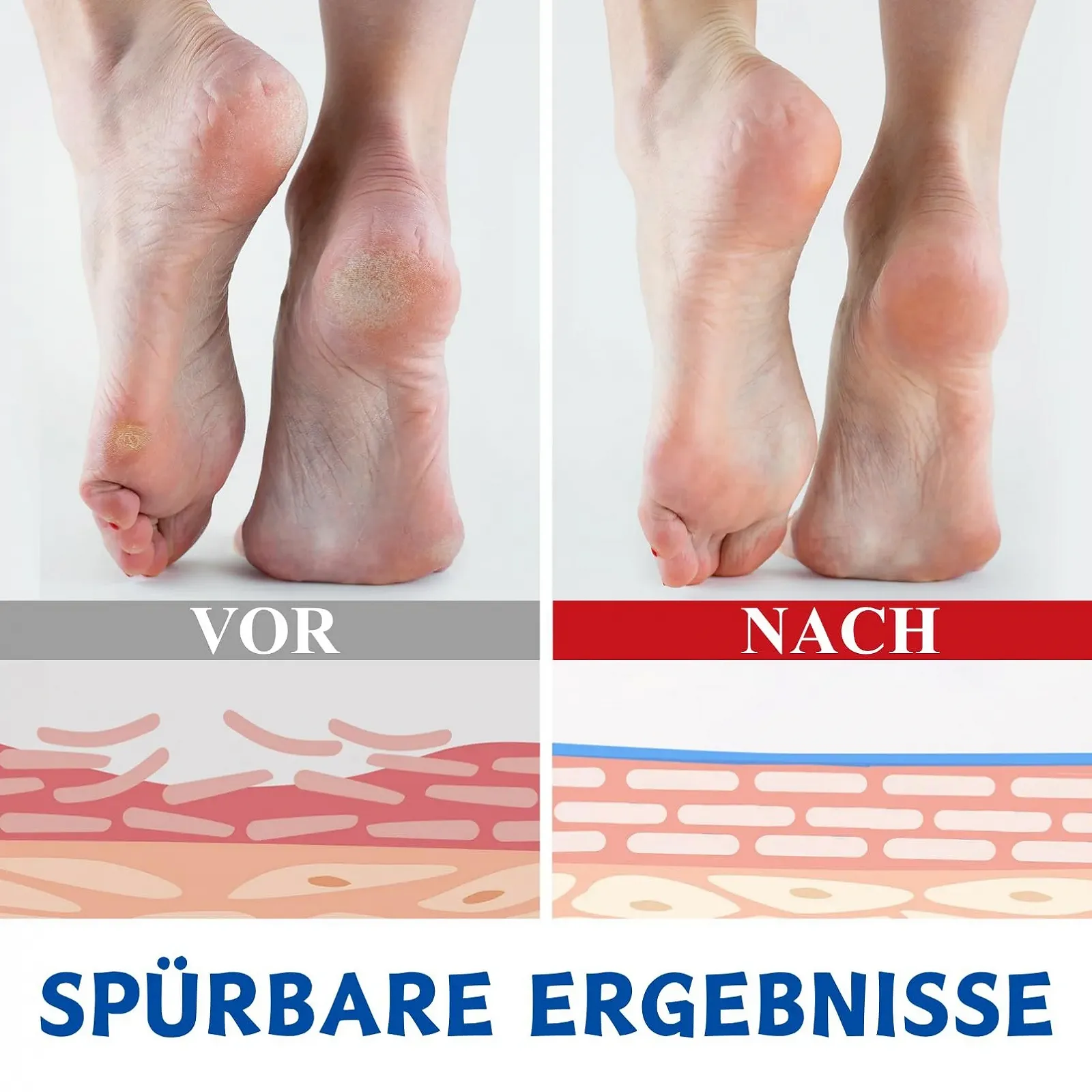 Набор кремов с мочевиной 60% 2 шт., фото №4