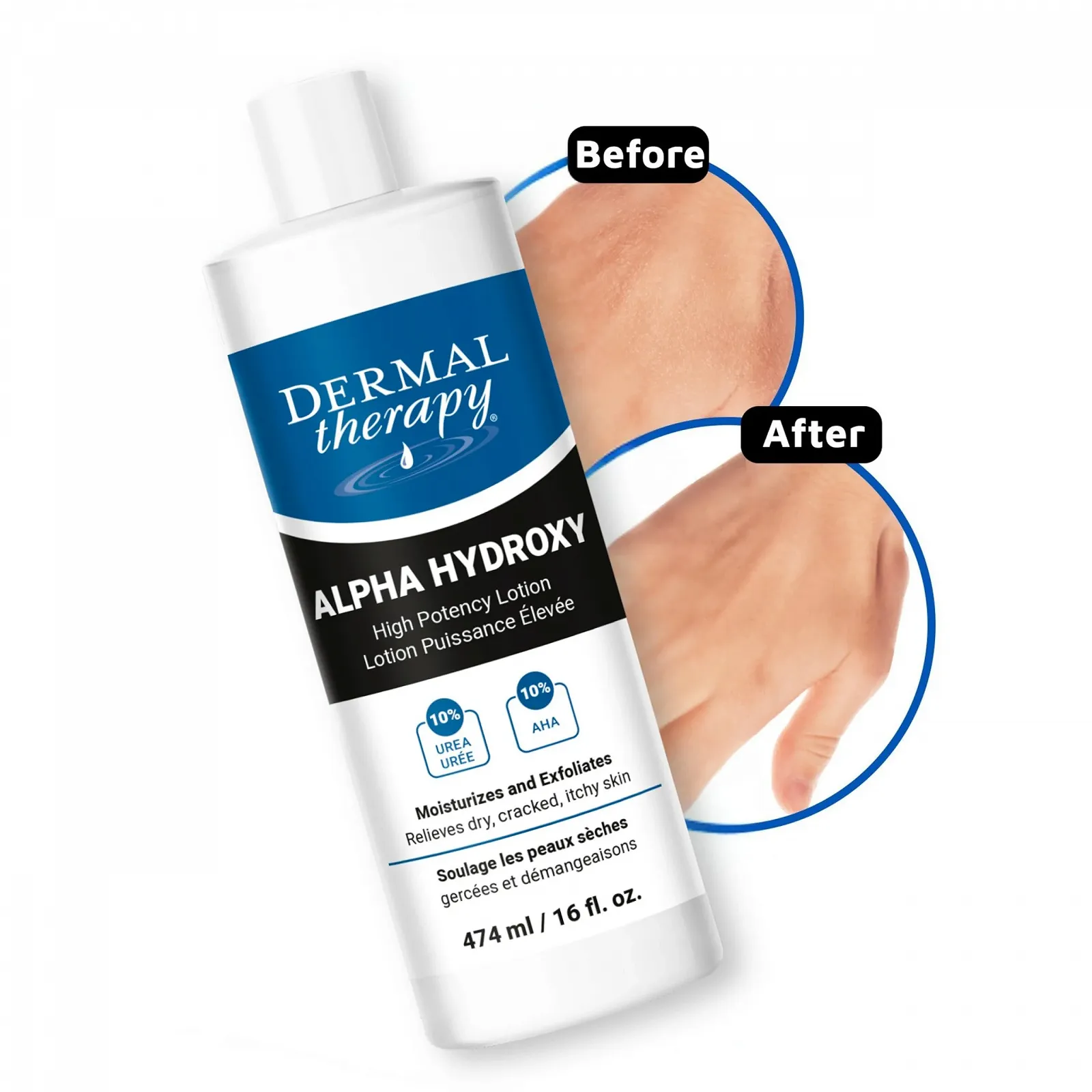 Лосьйон Dermal Therapy Alpha Hydroxy High Potency - Зволожуючий та відлущуючий засіб для сухої шкіри 10% сечовини, фото №8