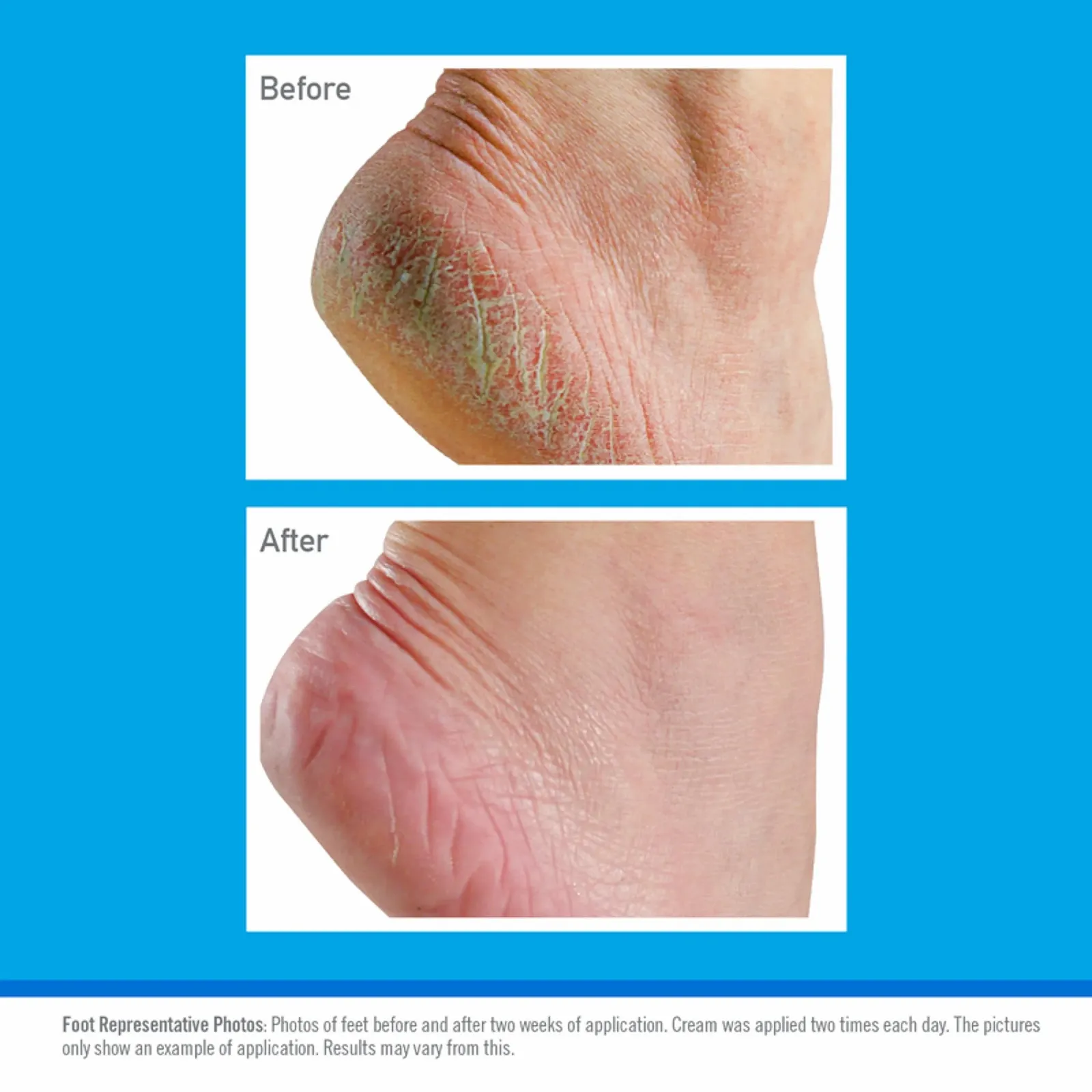 Крем для ног O'Keeffe's Healthy Feet Tube в тубе 80 мл (2 шт.), фото №3