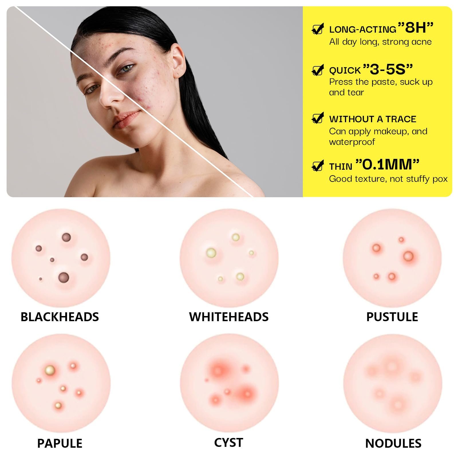 Патчі від прищів Tkekruh, 10 шт., патчі від прищів, потовщені, фото №3