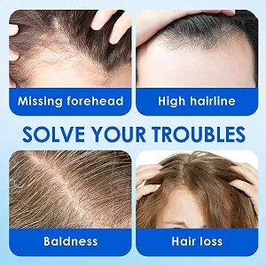 Сыворотка для кожи головы 60 мл для мужчин и женщин, сыворотка для роста волос, натуральный рост волос, для более густых и крепких волос, для утолщения и укрепления роста волос, используется для редких волос synthetic.ua - Фото 1