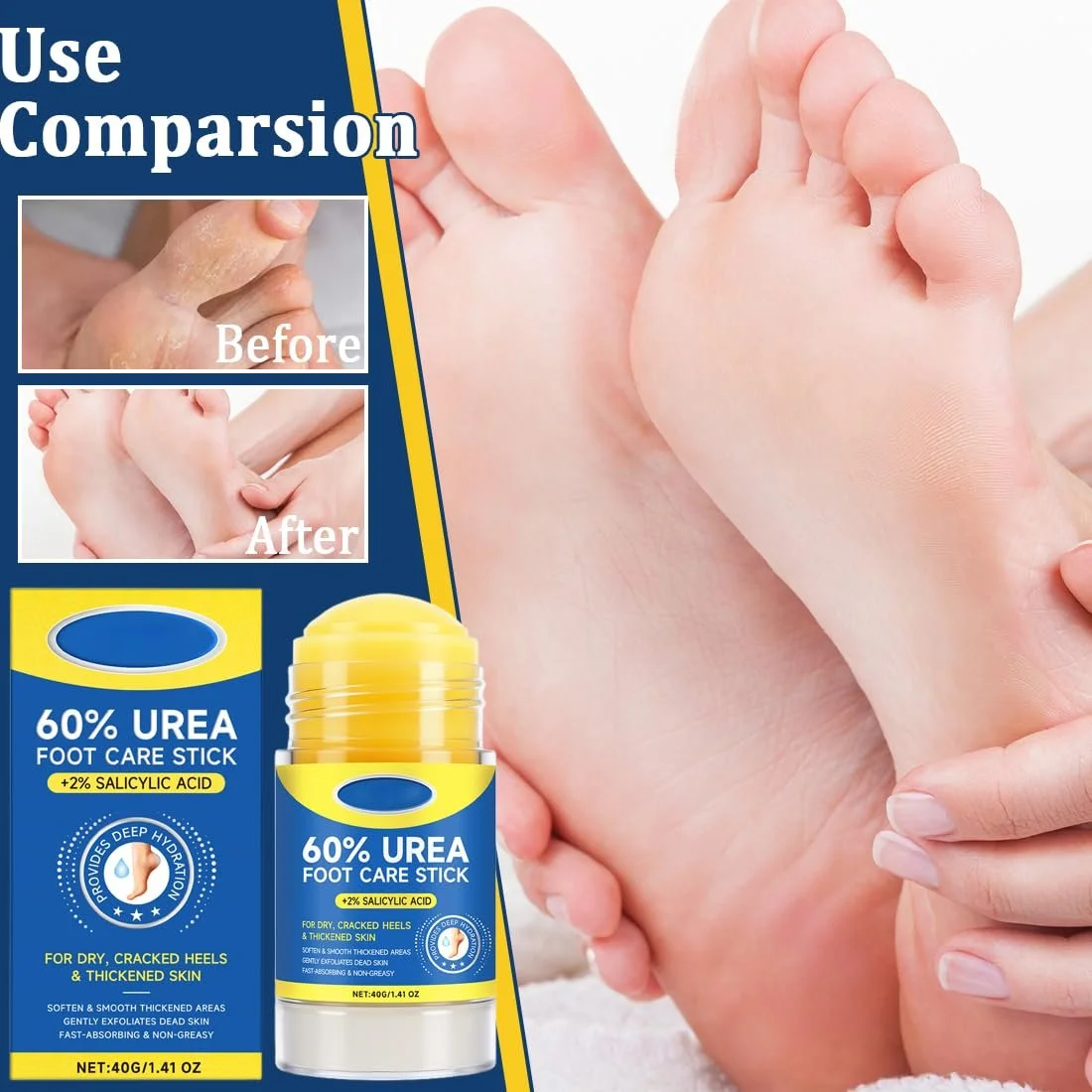 Стик-крем для ног с мочевиной 60% для потрескавшихся пяток и сухой кожи 30 г, фото №4