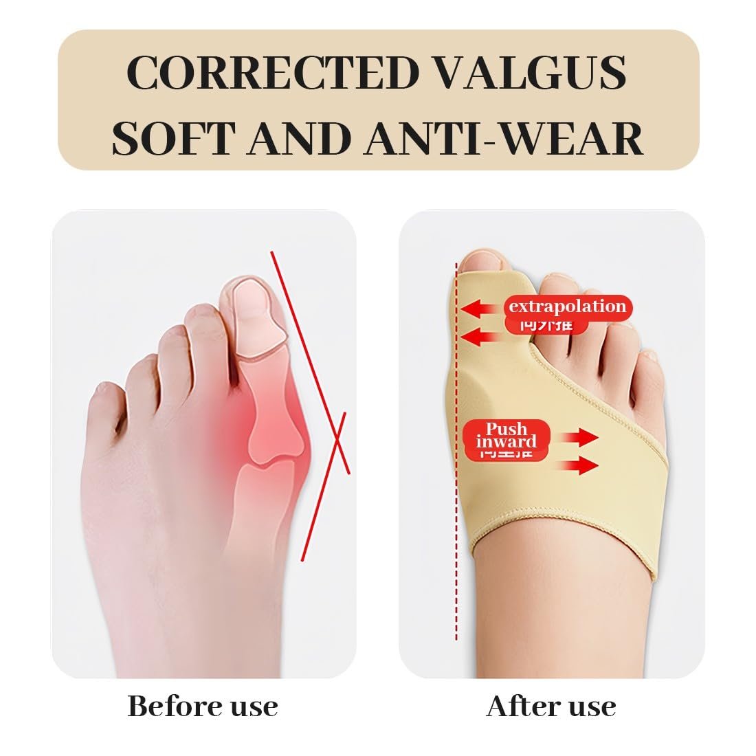 Пов'язка Захисна Для Великого Пальця Стопи 2 шт., фото №5