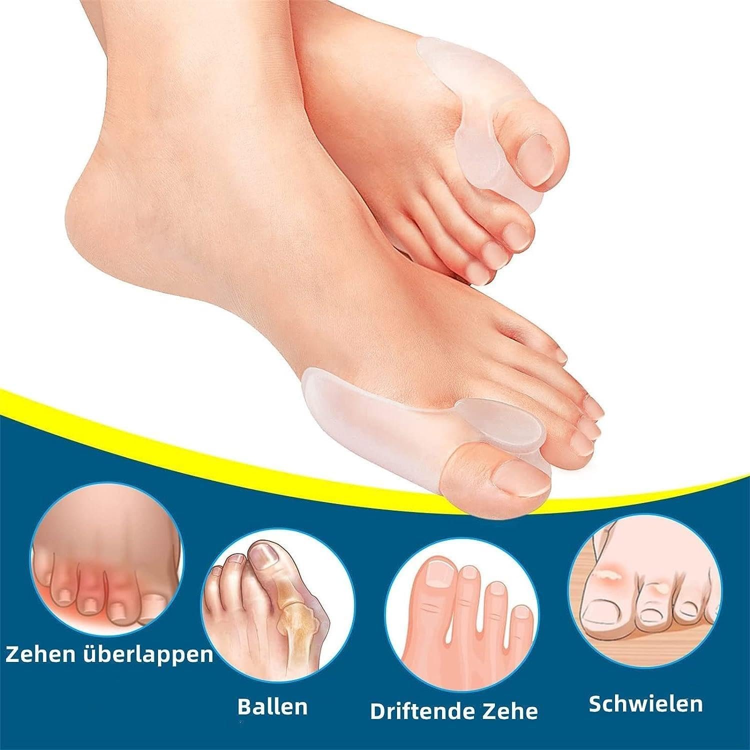 Роздільник для пальців ніг Hallux Valgus 8x, роздільник для пальців ніг, випрямляч, фото №3