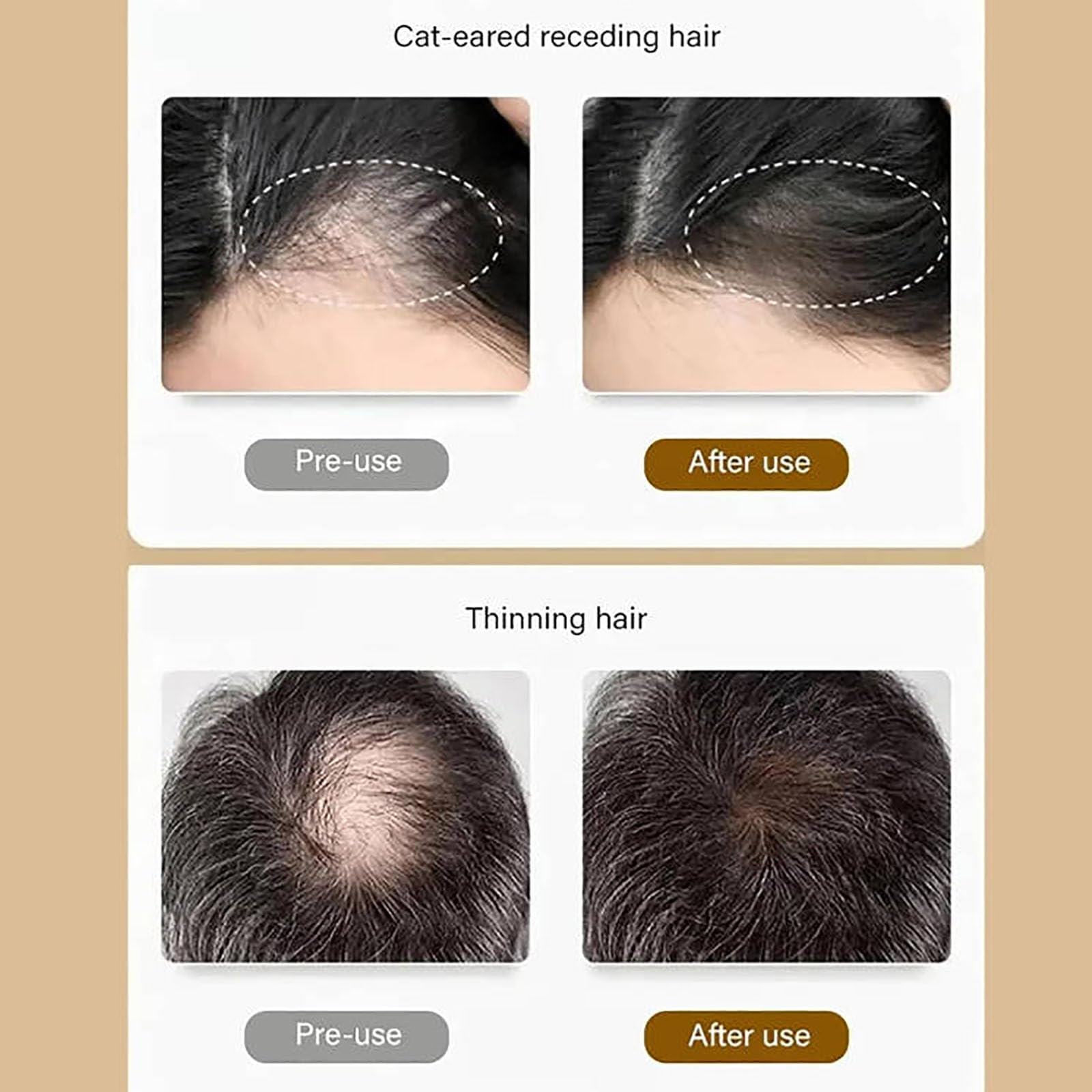 Шампунь HIDRUO Ginger Plant Extract Anti-Hair Loss Ginger для всіх типів волосся (1 шт.), фото №4