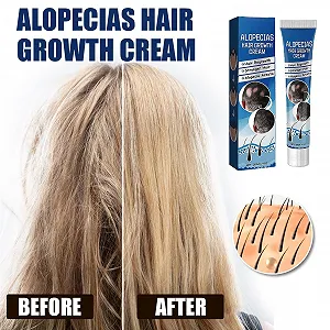 Крем для роста волос, 20 г, крем для восстановления роста, укрепляет корни, способствует здоровью кожи головы и восстанавливает рост, ускоряет рост волос synthetic.ua - Фото 1