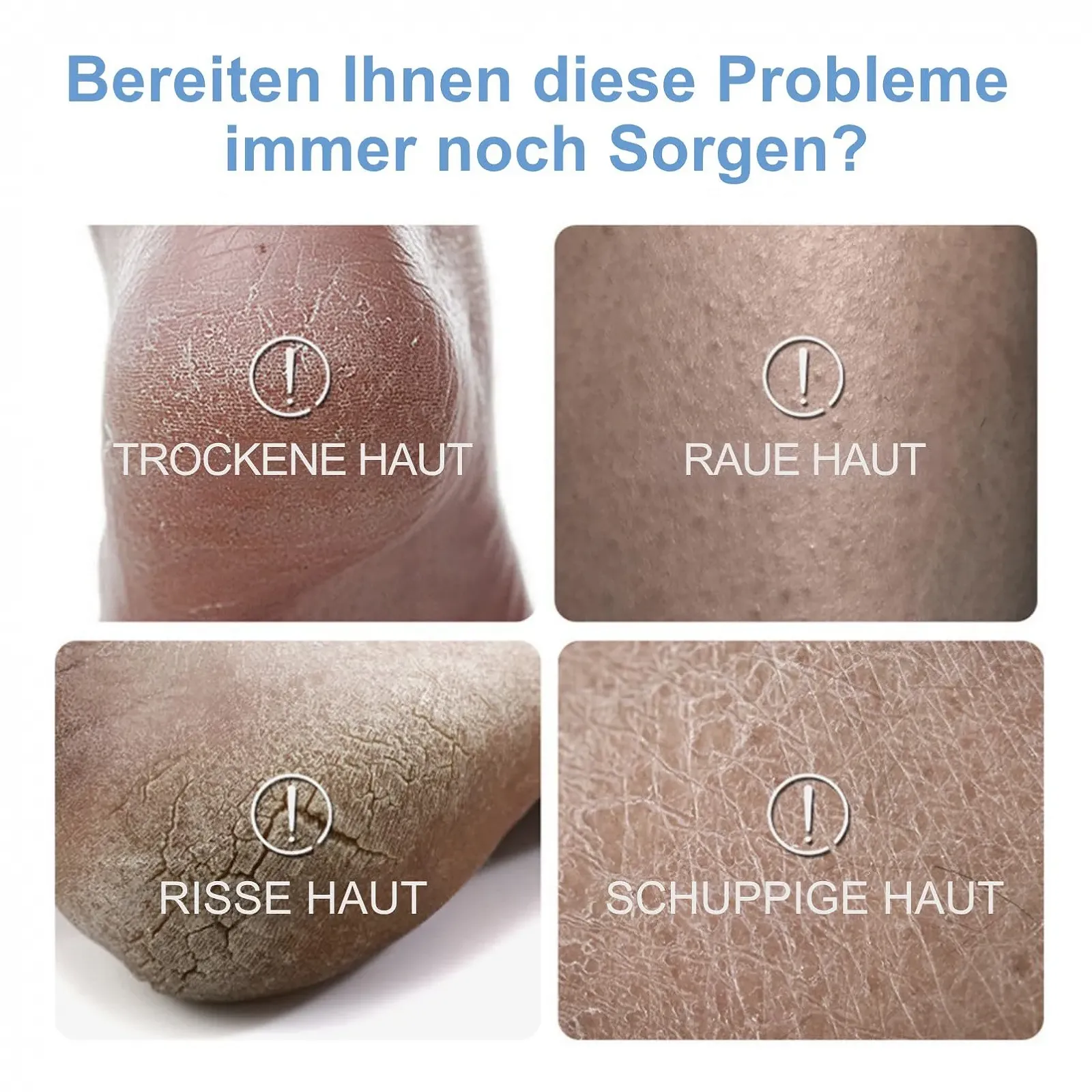 Крем для ног и рук с мочевиной 50% 100 г, фото №6