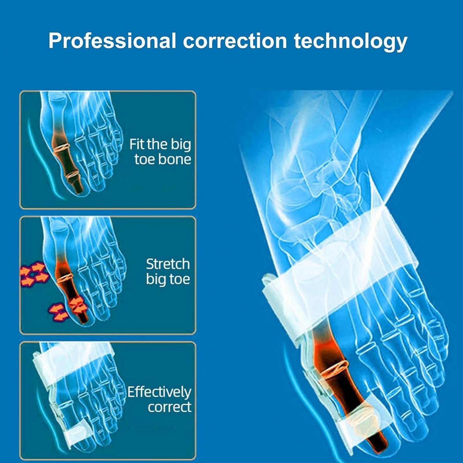 Шина для корекції великого пальця стопи Zehenglätter Для вальгусної деформації, 2 шт, фото №6