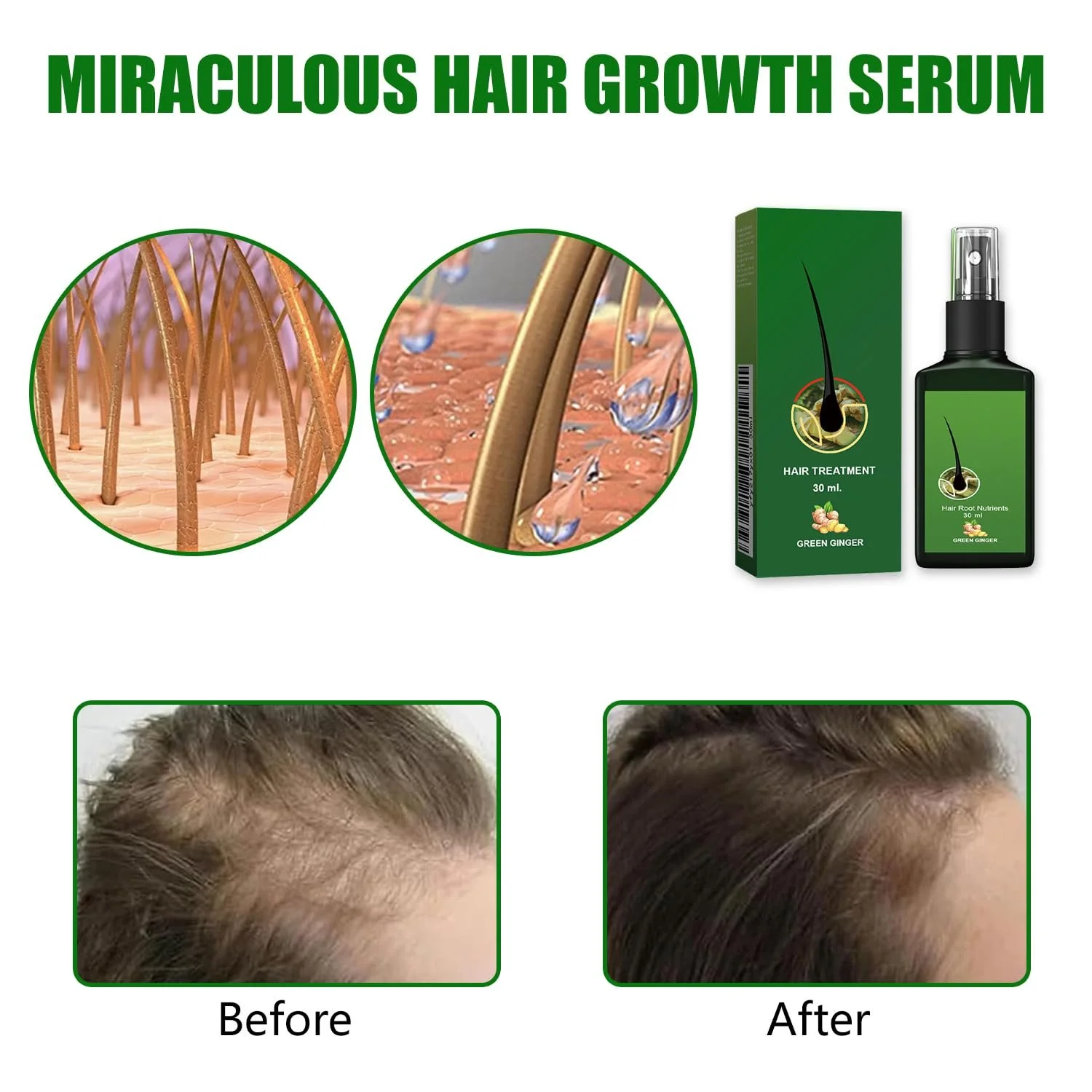 Спрей Імбирний Живильний для Стимуляції Росту Волосся Сироватка проти Випадіння, фото №5 Спрей Імбирний Живильний для Стимуляції Росту Волосся Сироватка проти Випадіння, фото №5
