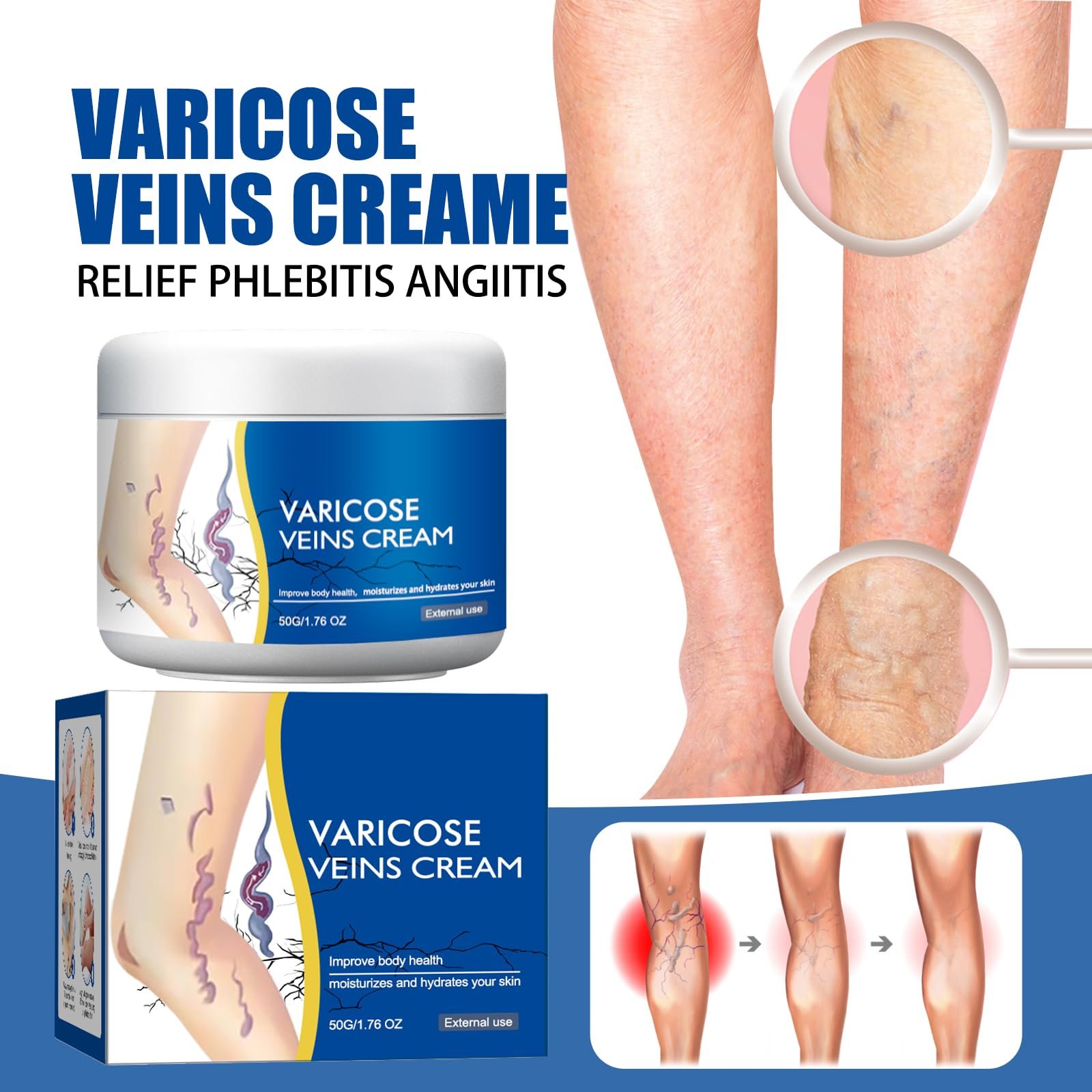 Крем-бальзам для ніг Varicose Veins Cream Natural Leg Care проти варикозу та судинних зірочок, фото №2