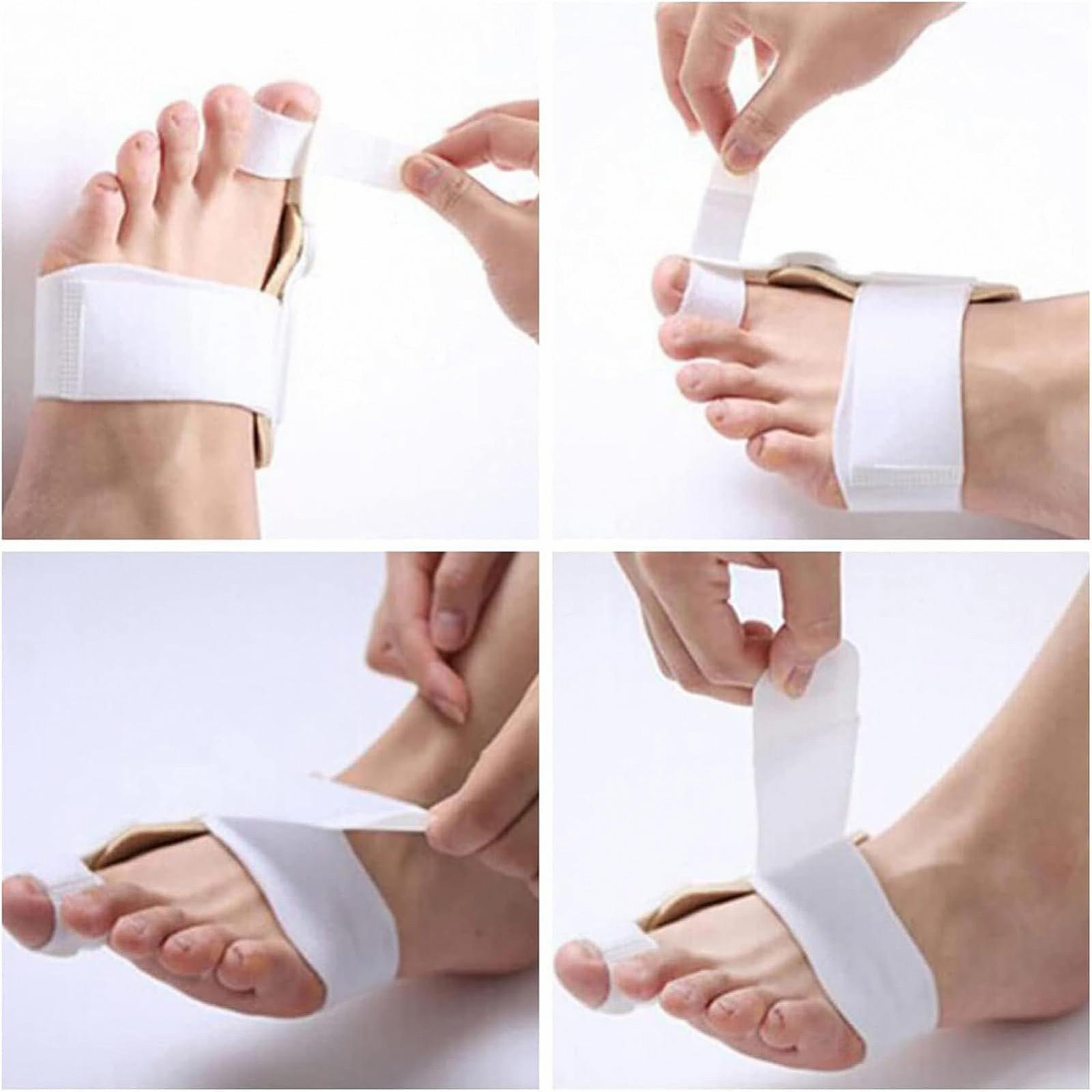 Шина для корекції великого пальця стопи Zehenglätter Для вальгусної деформації, 2 шт, фото №2