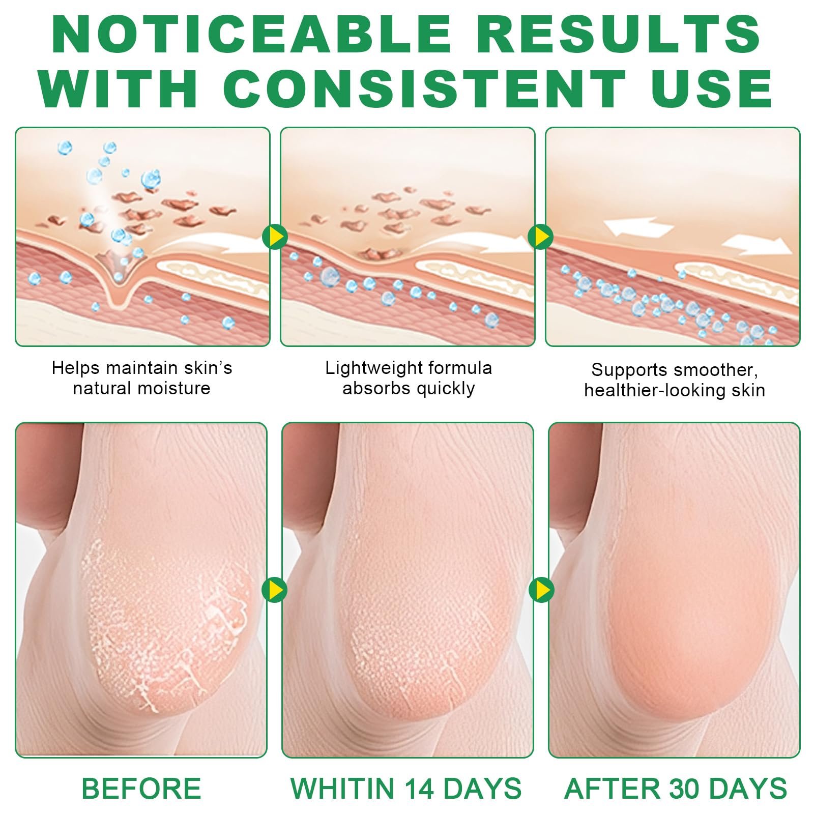 Бальзам-стік для ніг Cracked Heel Repair зволожувальний з сечовиною Smooth, фото №6