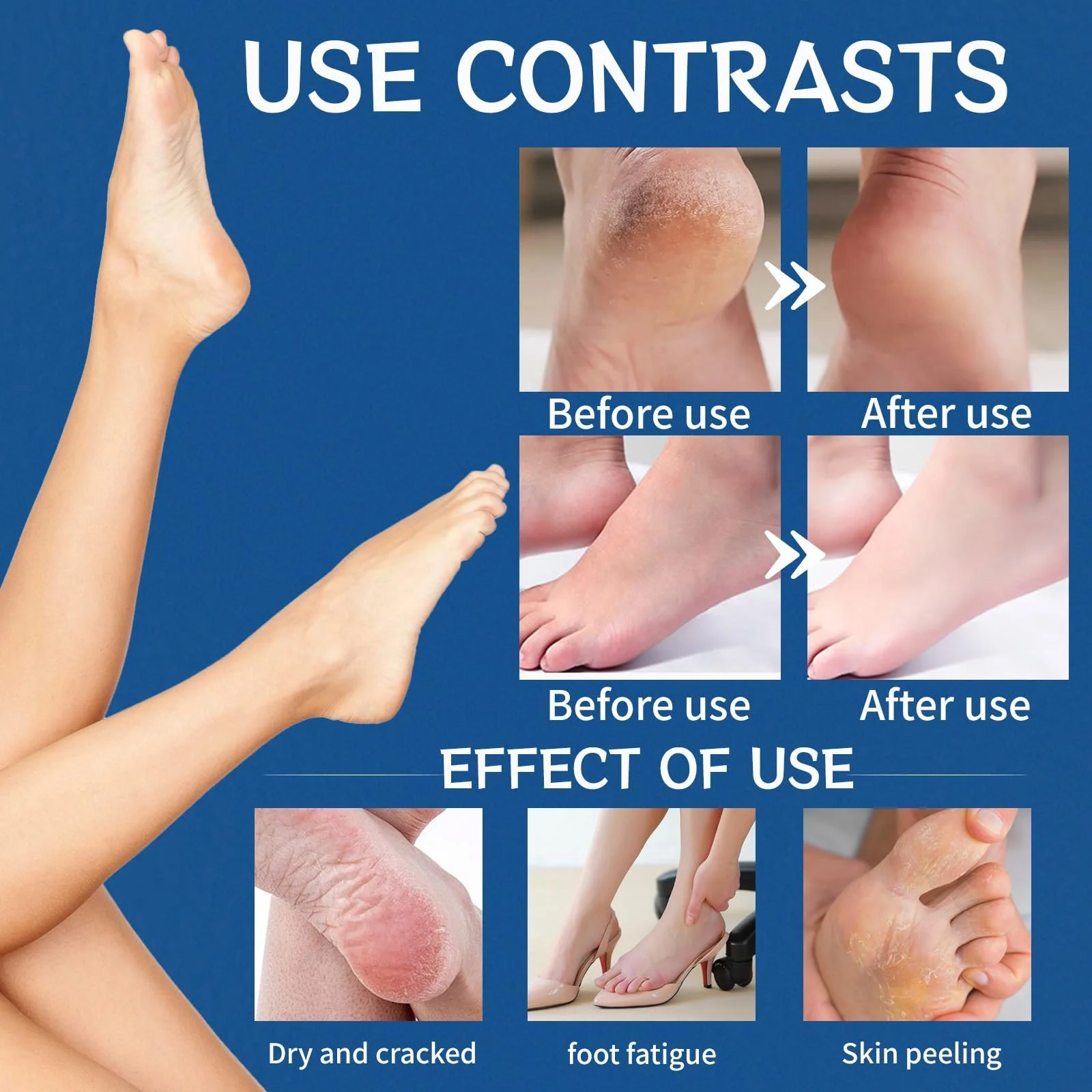 Крем Urea 40% для ног и рук восстанавливающий лосьон, фото №3