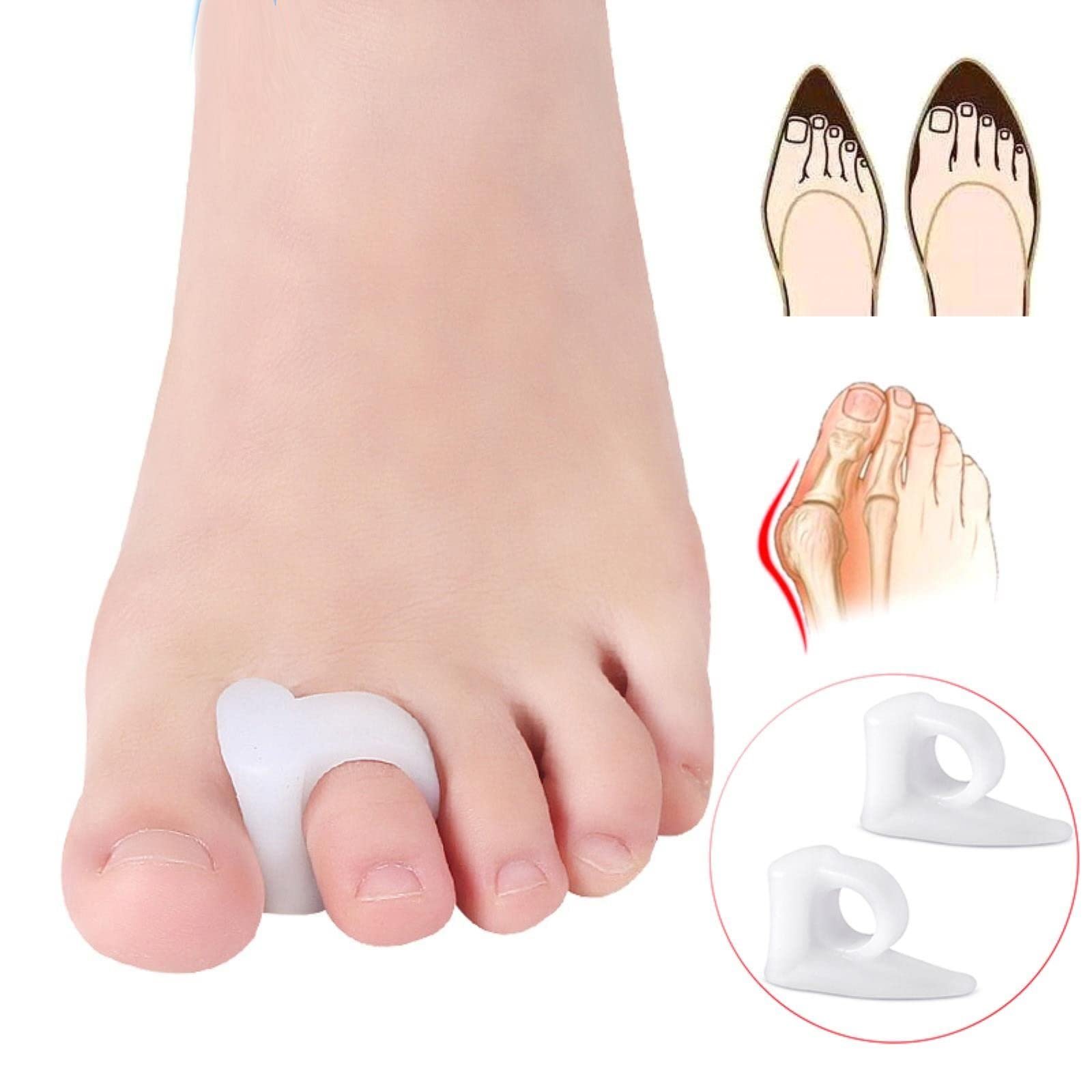 Роздільник для пальців ніг Гелевий коректор вальгусної деформації 2шт/пара, фото №7 Роздільник для пальців ніг Гелевий коректор вальгусної деформації 2шт/пара, фото №7