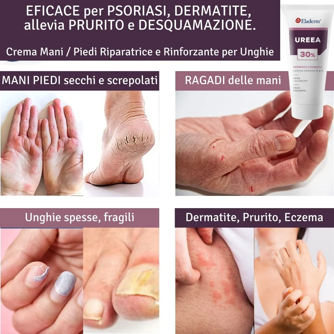 Крем с мочевиной 30% Eladerm 100 мл, фото №4 Крем с мочевиной 30% Eladerm 100 мл, фото №4