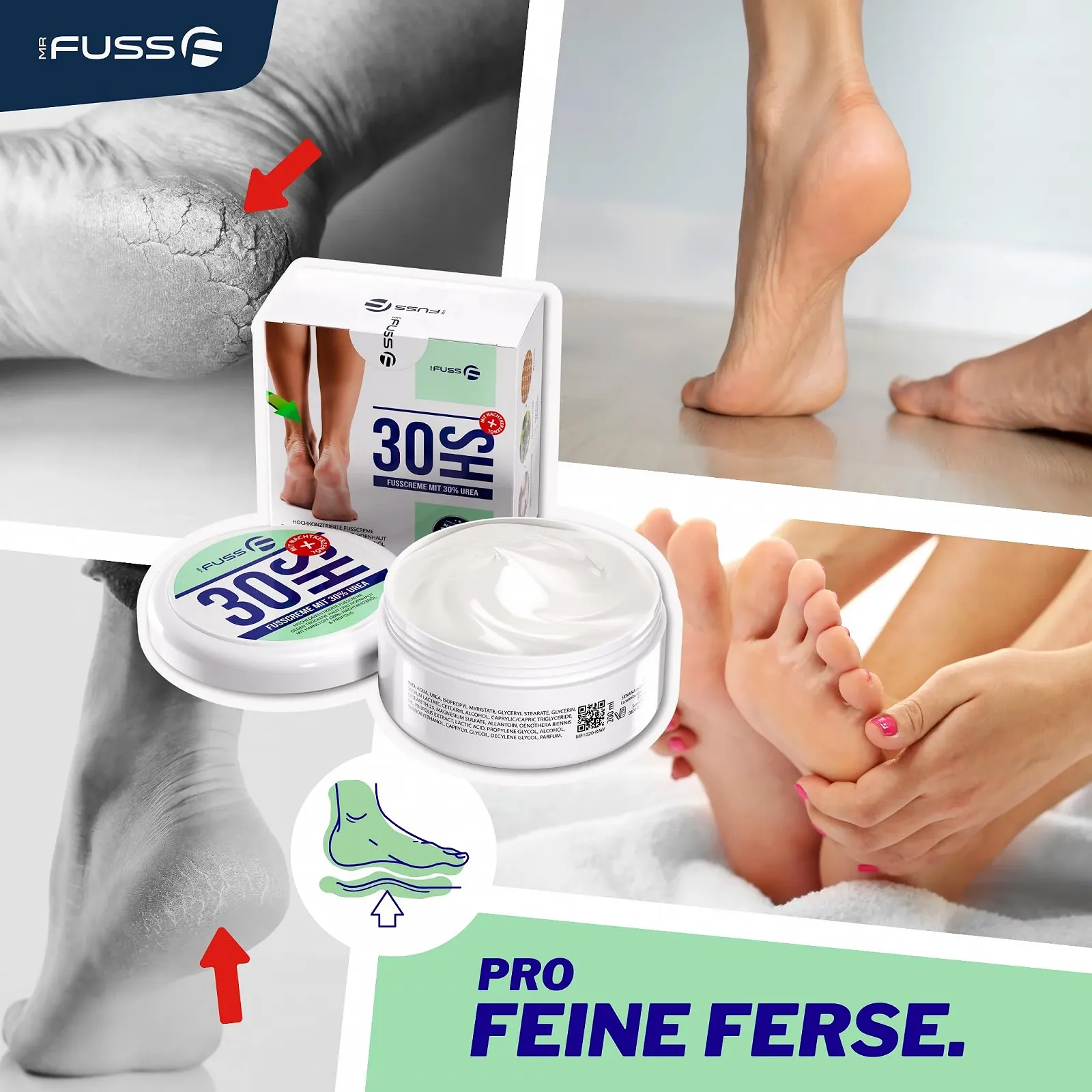 Крем от мозолей Mr. Fuss Urea 30% с маслом примулы вечерней, глицерином и прополисом 200 мл, фото №5