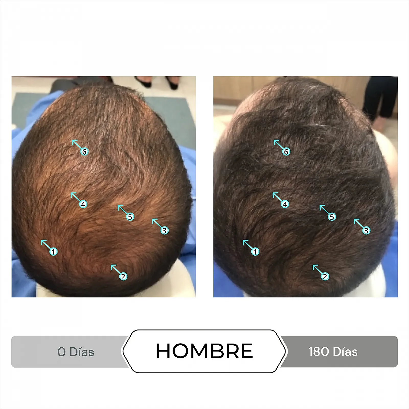 Терапія для потовщення волосся Spectral DNC-S 60 мл, фото №7