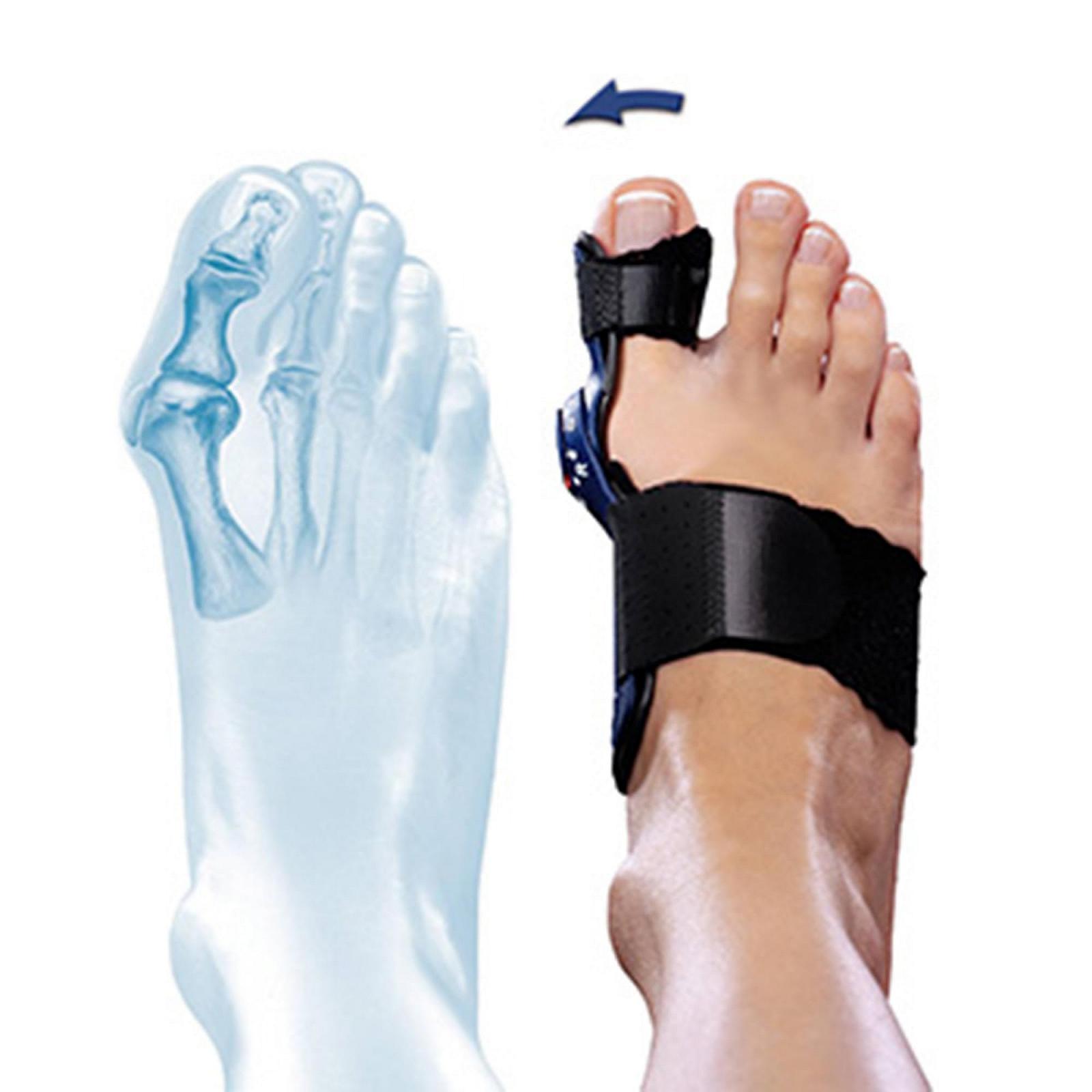 Шина ValguLoc II Універсальна 1 шт. для правої/лівої ноги, фото №3