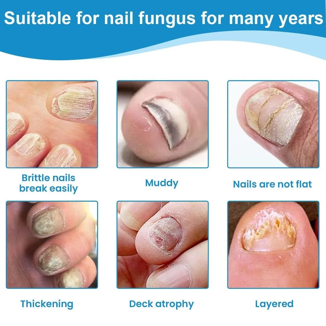 Спрей для догляду за ногами та нігтями 100 мл, фото №5