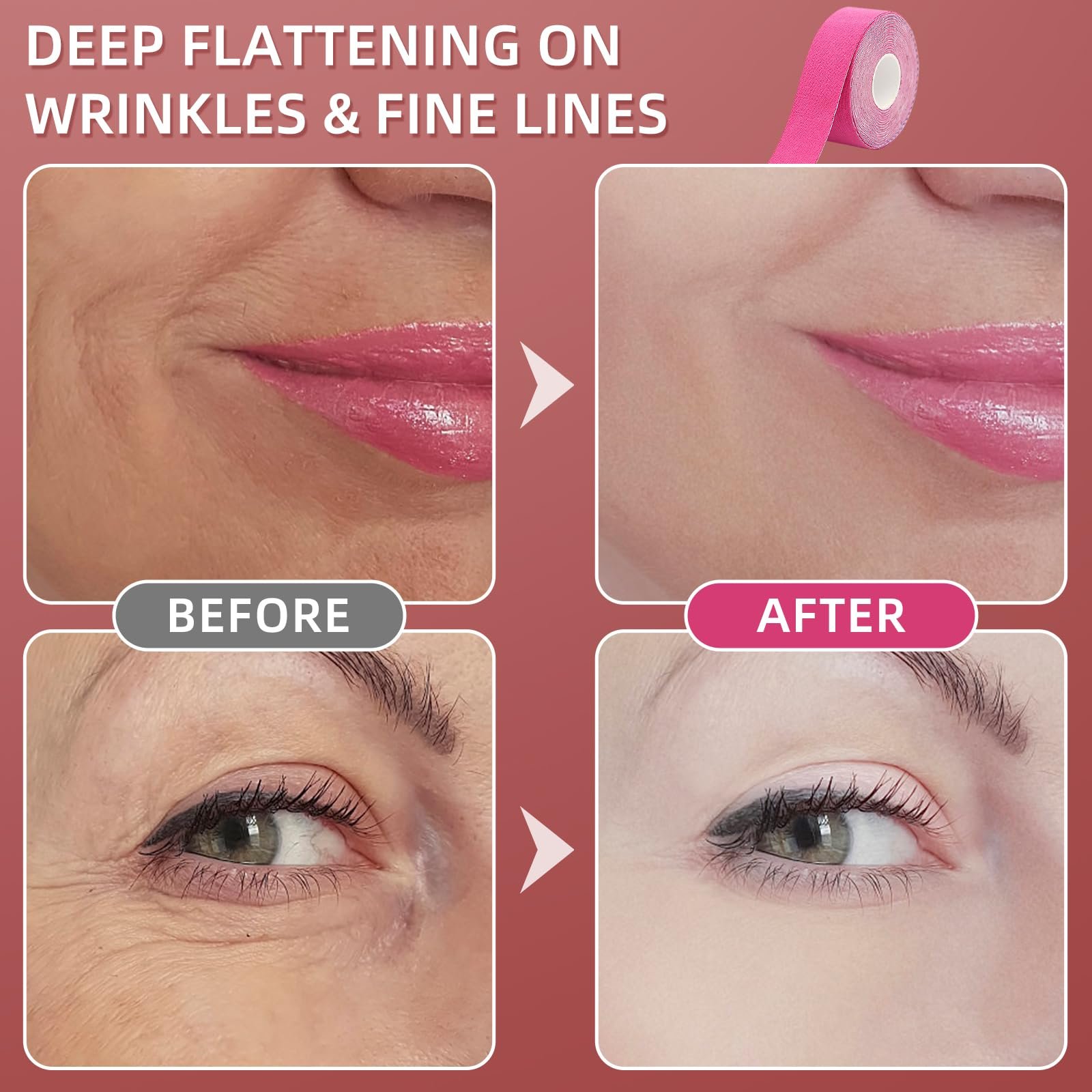 Лента для подтяжки лица Kisvic, 2 шт, фото №5