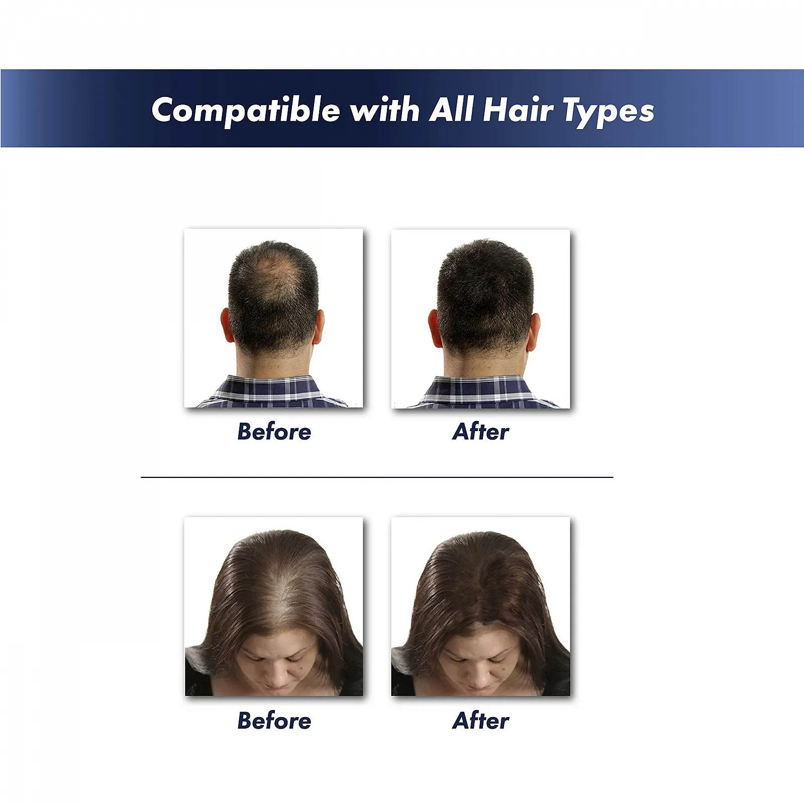 Волокна для волосся KeraFiber Натуральний кератин для чоловіків і жінок Повне покриття за 30 секунд 5 г Чорний, фото №2