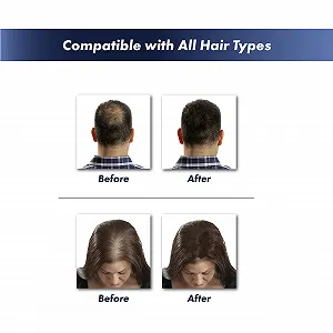 Волокна для волос KeraFiber Натуральный кератин для создания волос для мужчин и женщин Полное покрытие за 30 секунд 5 г Черный synthetic.ua - Фото 1