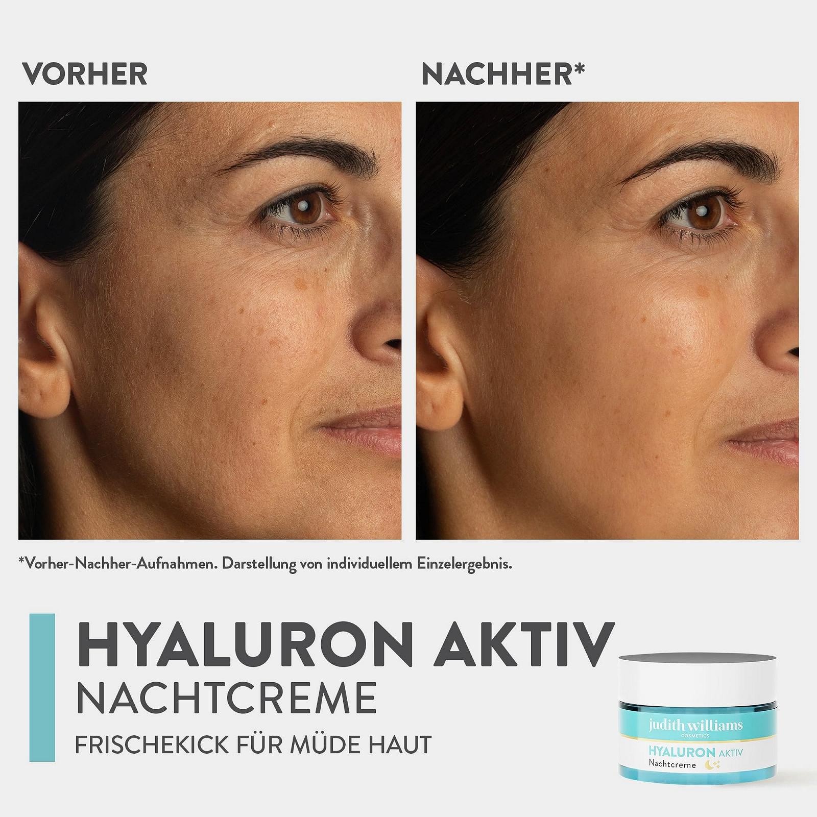 Набір для догляду за обличчям Judith Williams Hyaluronic Active Day and Night Cream 2 x 50 мл, фото №8 Набір для догляду за обличчям Judith Williams Hyaluronic Active Day and Night Cream 2 x 50 мл, фото №8