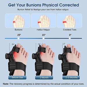 Коректор великого пальця стопи EVISTR Регульований Подвійна корекція для чоловіків і жінок Ліва і права нога Ортопедична шина synthetic.ua - Фото 1