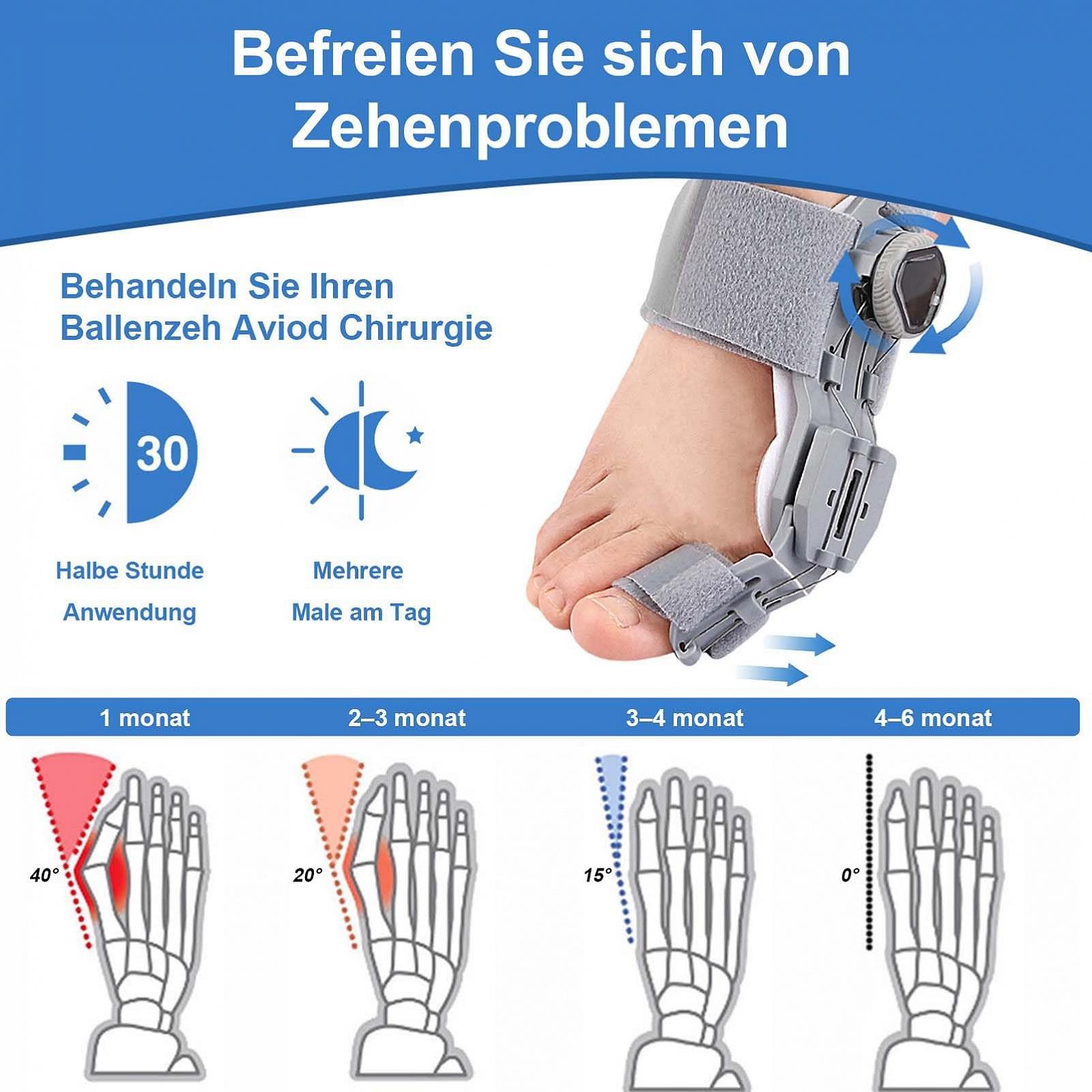 Шина для корекції Hallux Valgus Yeelan, шина Hallux Valgus з 2 силіконовими ремінцями, фото №2 Шина для корекції Hallux Valgus Yeelan, шина Hallux Valgus з 2 силіконовими ремінцями, фото №2