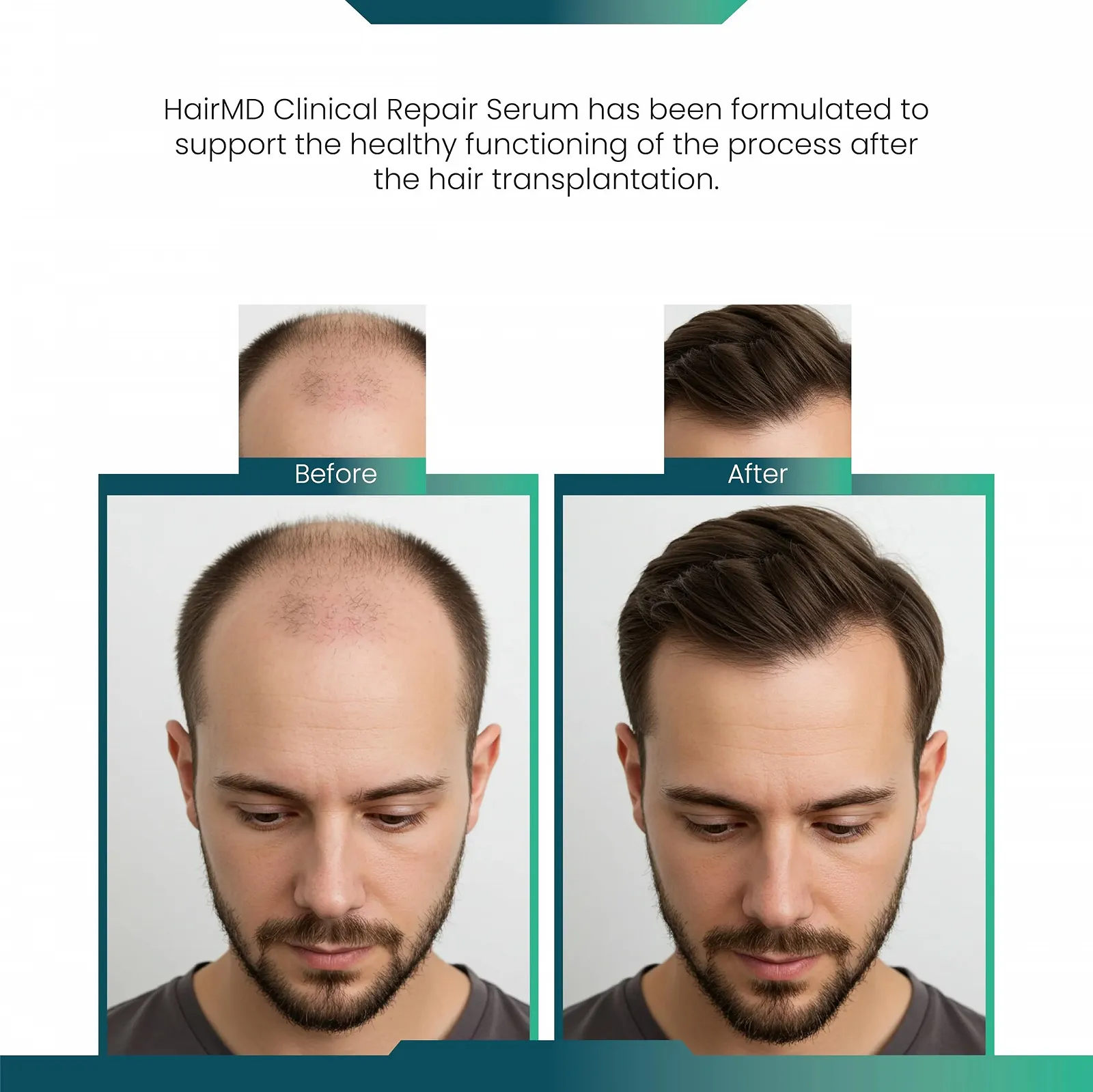 Сироватка HairMD Clinical Repair 60 мл, фото №3