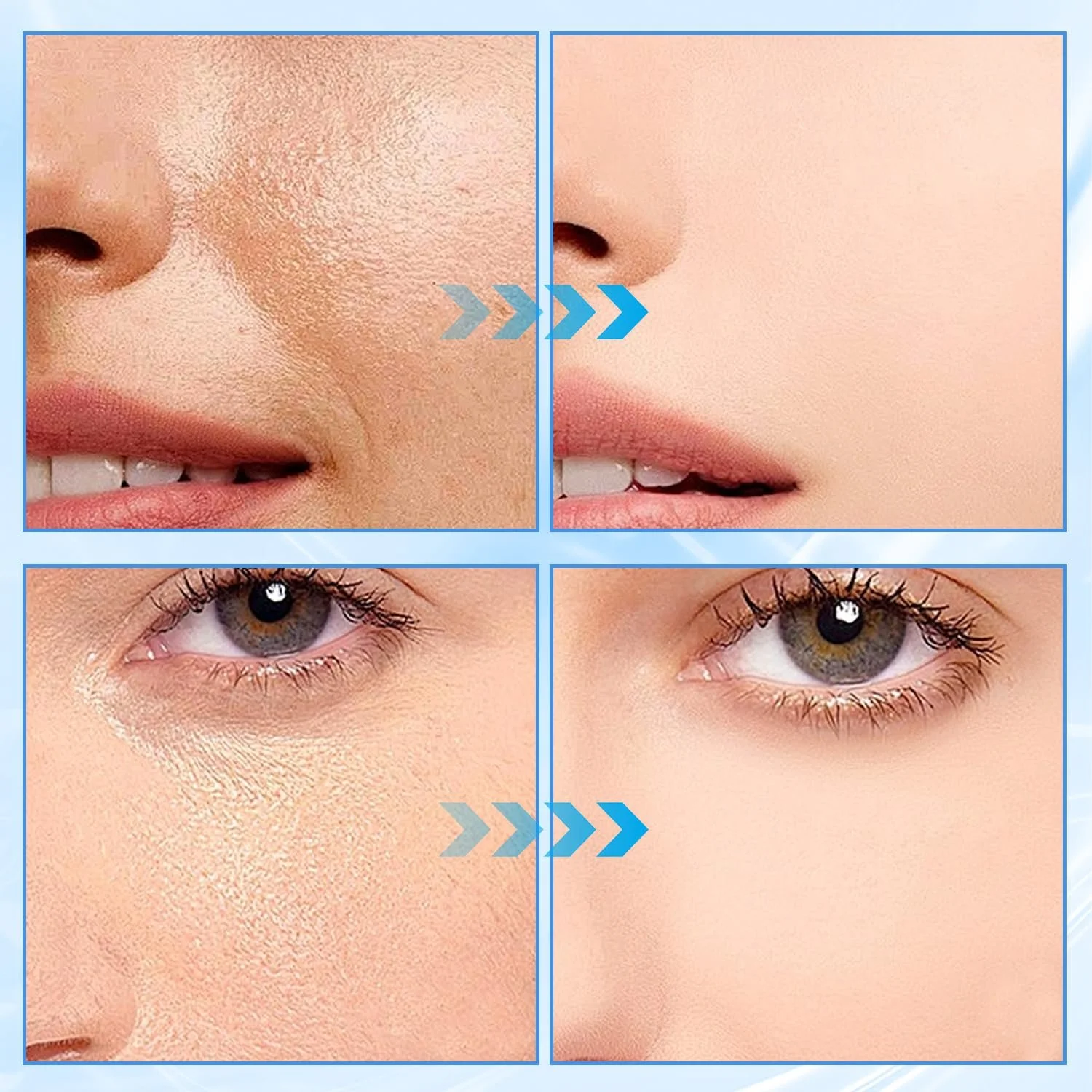 Пластирі проти зморшок 20 шт для обличчя від зморшок навколо рота, фото №7