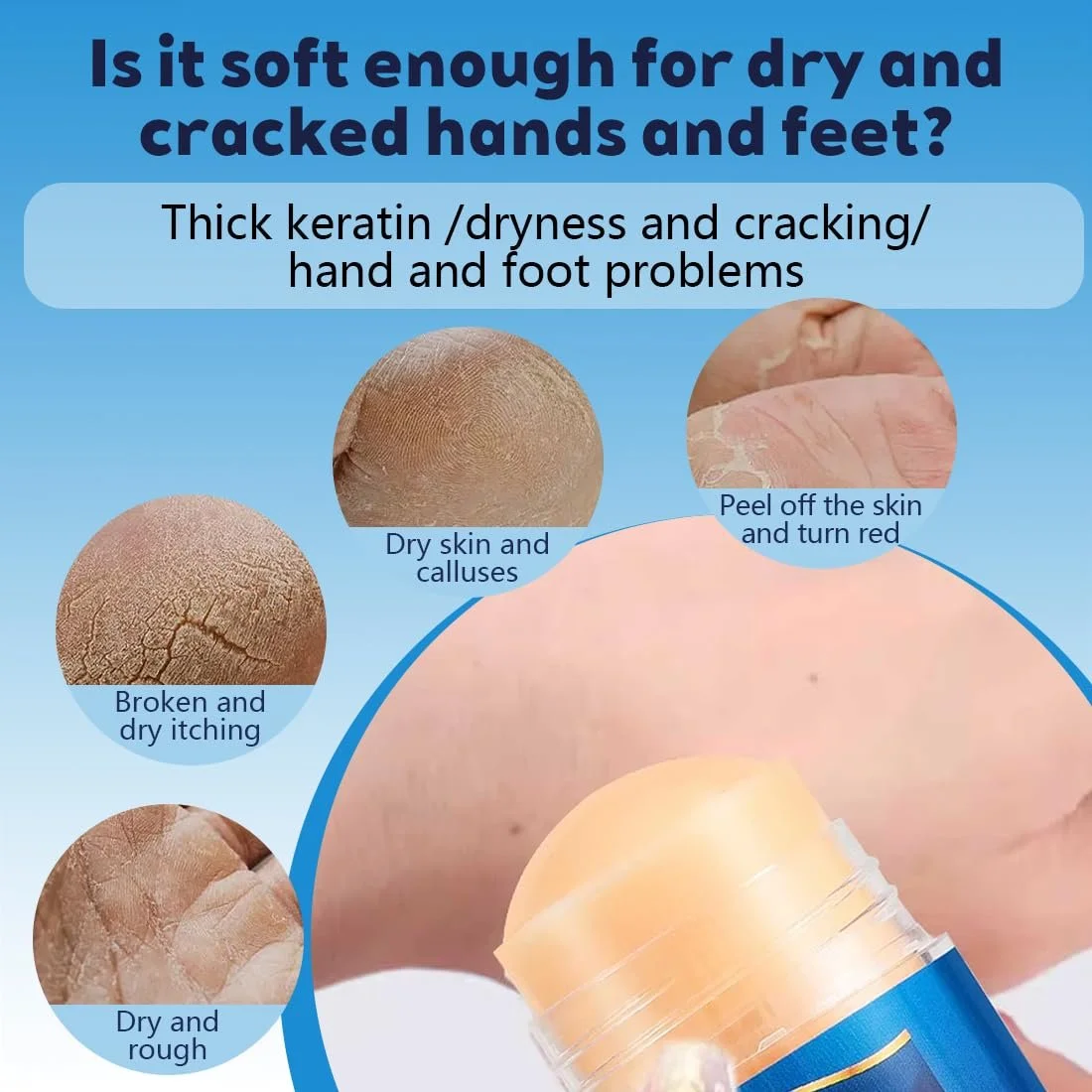 Крем-стик для ног увлажняющий против трещин с мочевиной 2 шт, фото №4